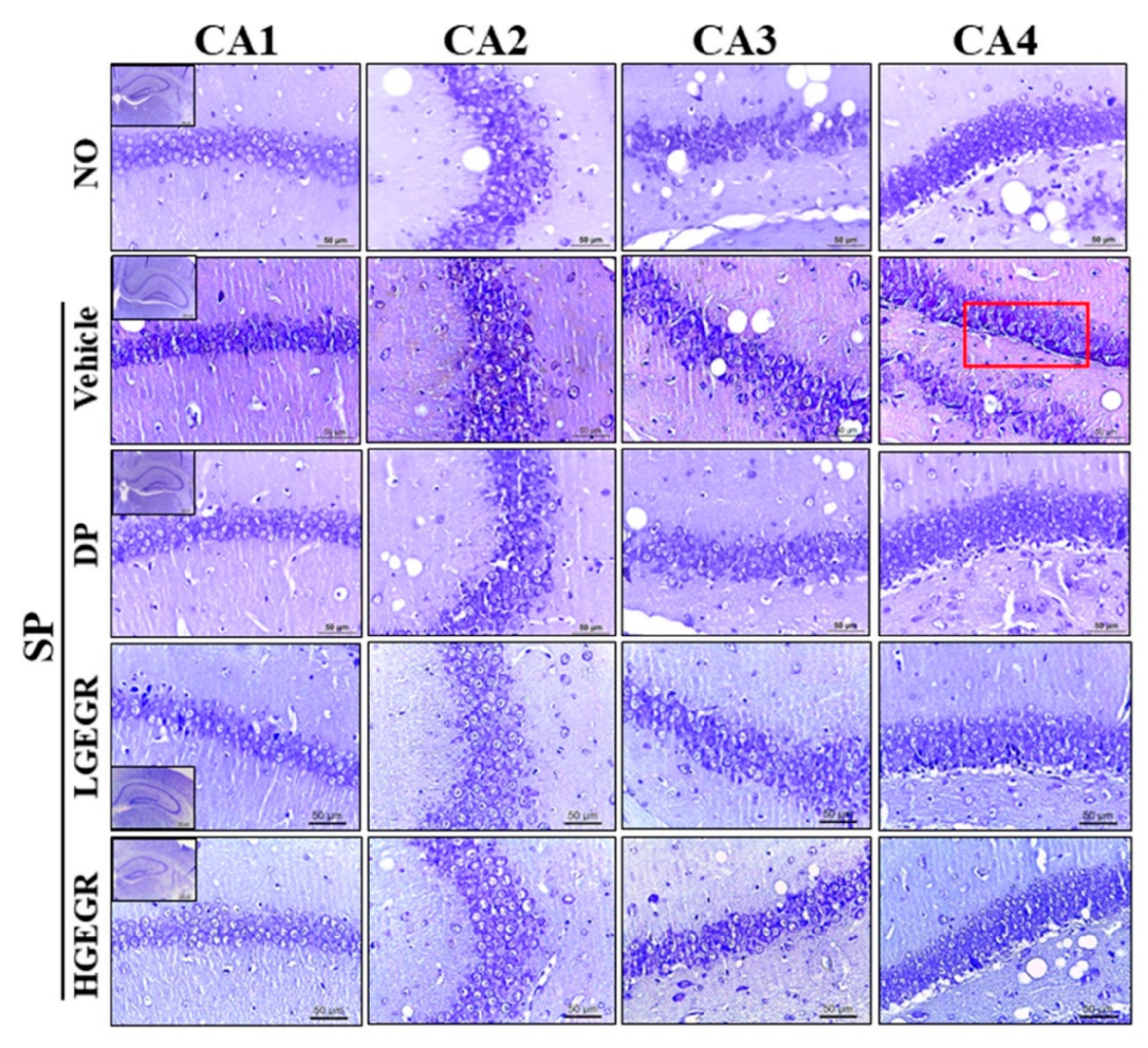 Antioxidants 08 00450 g007 Antioxidants 08 00450 g007