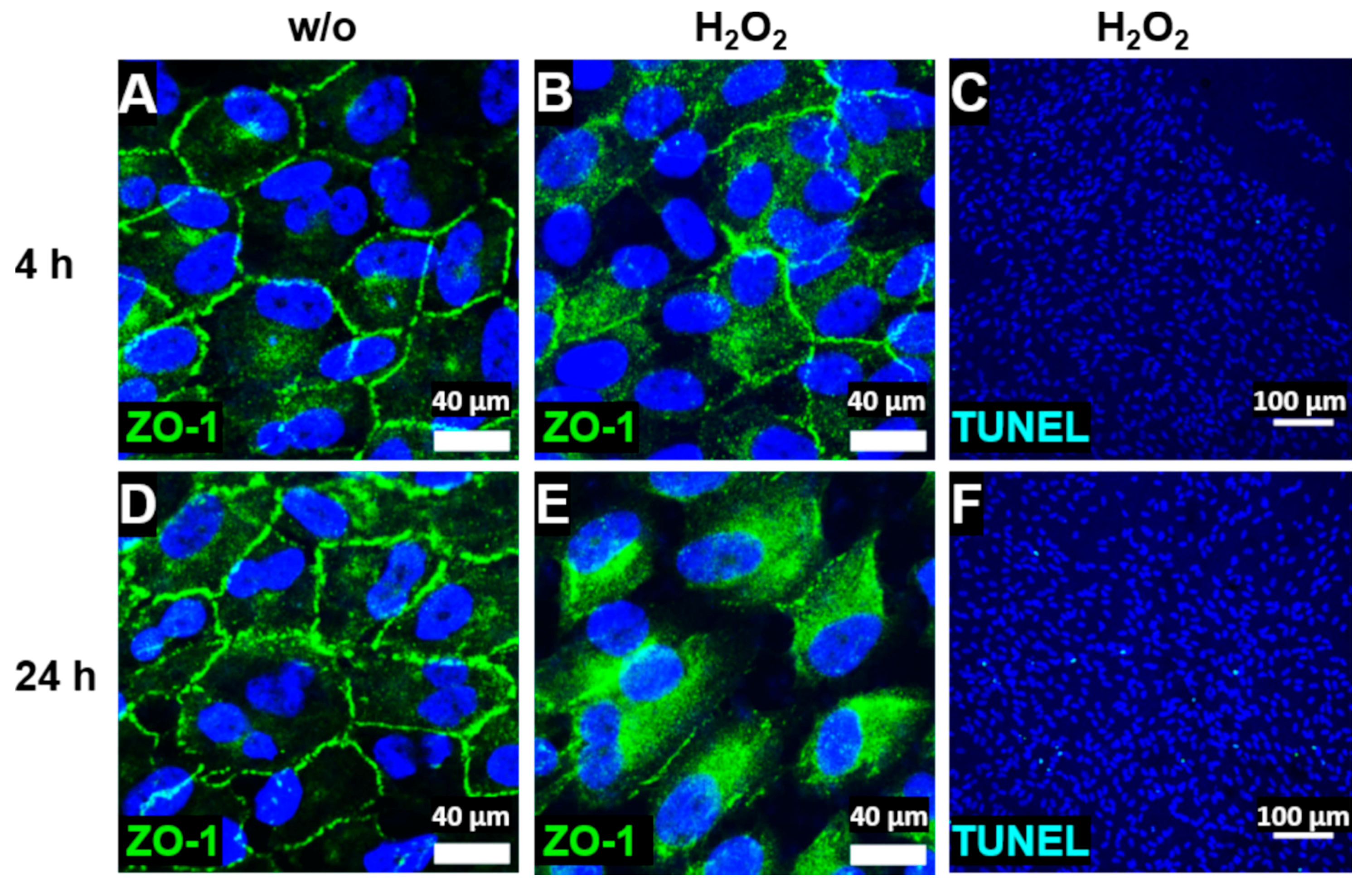 Antioxidants Free Full Text Oxidative Stress Increases Endogenous Complement Dependent Inflammatory And Angiogenic Responses In Retinal Pigment Epithelial Cells Independently Of Exogenous Complement Sources Html