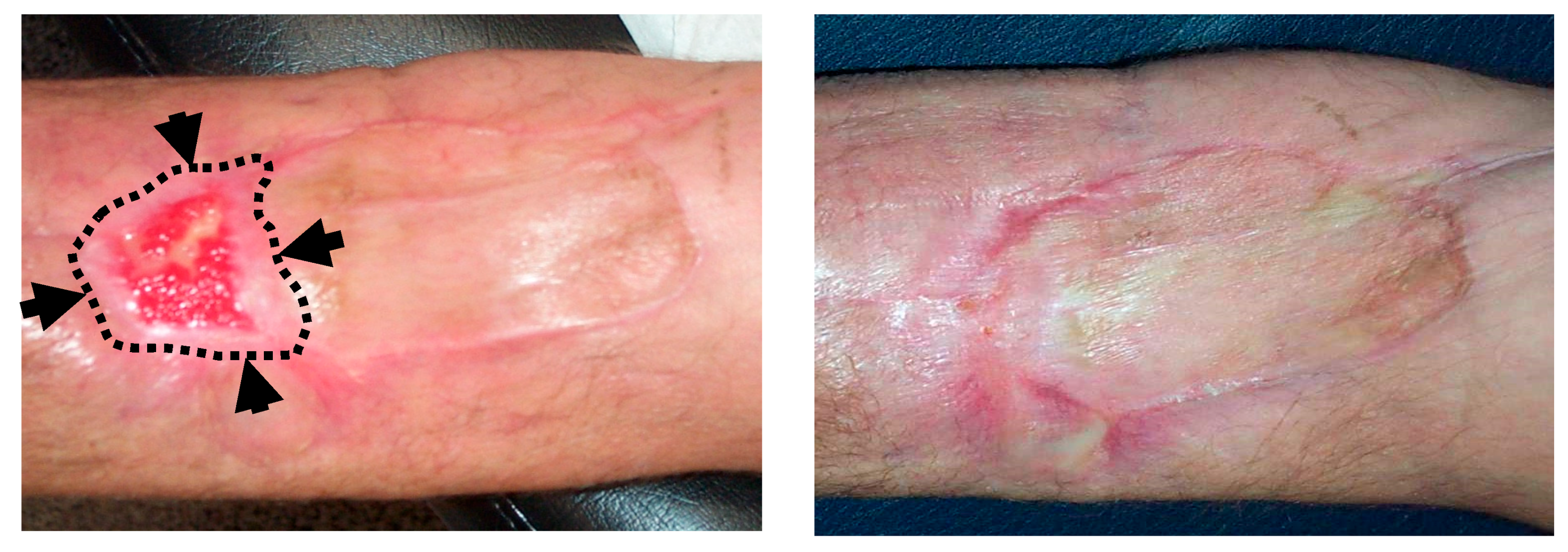 Antioxidants 08 00588 g004 Antioxidants 08 00588 g004