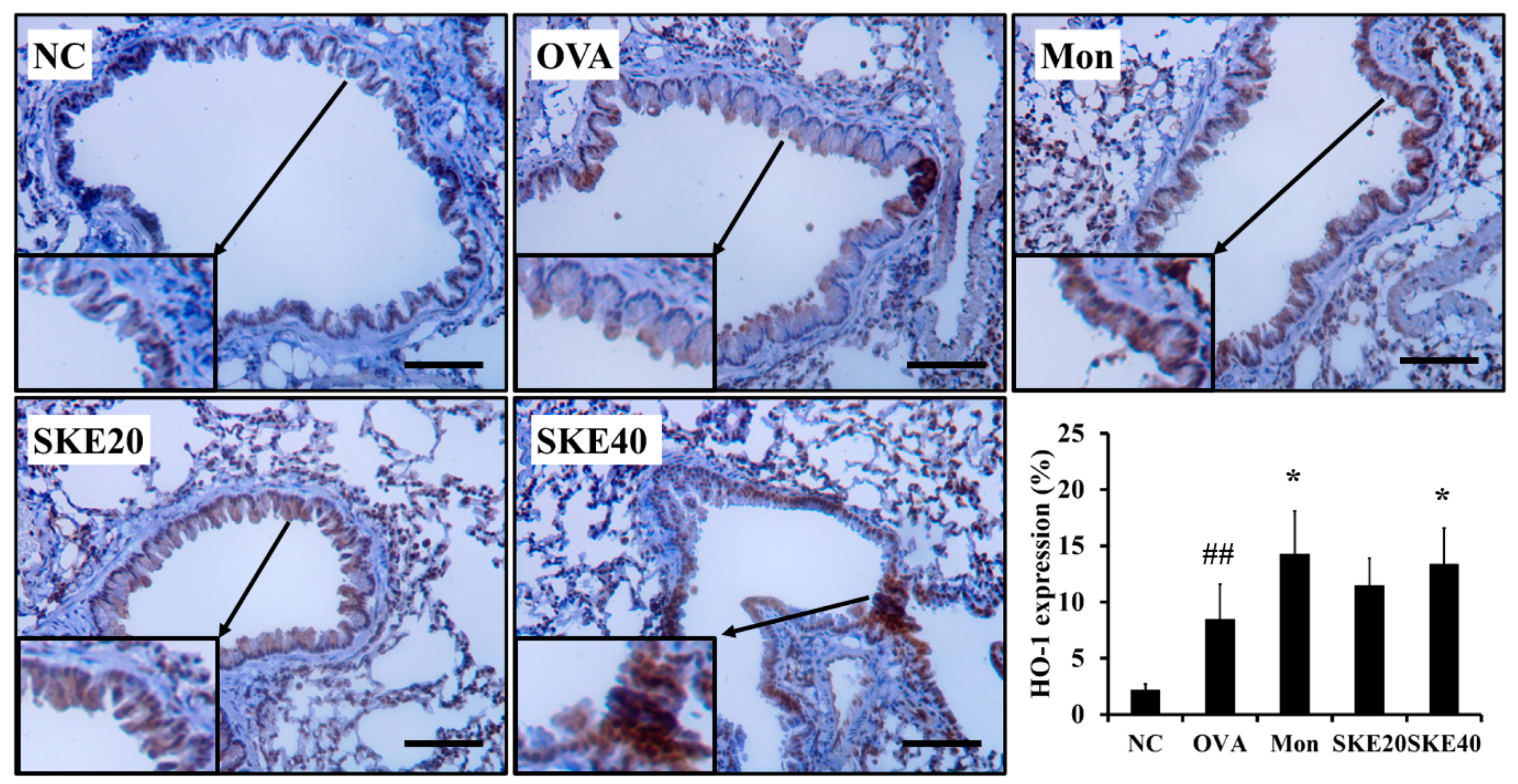 Antioxidants 09 00099 g009