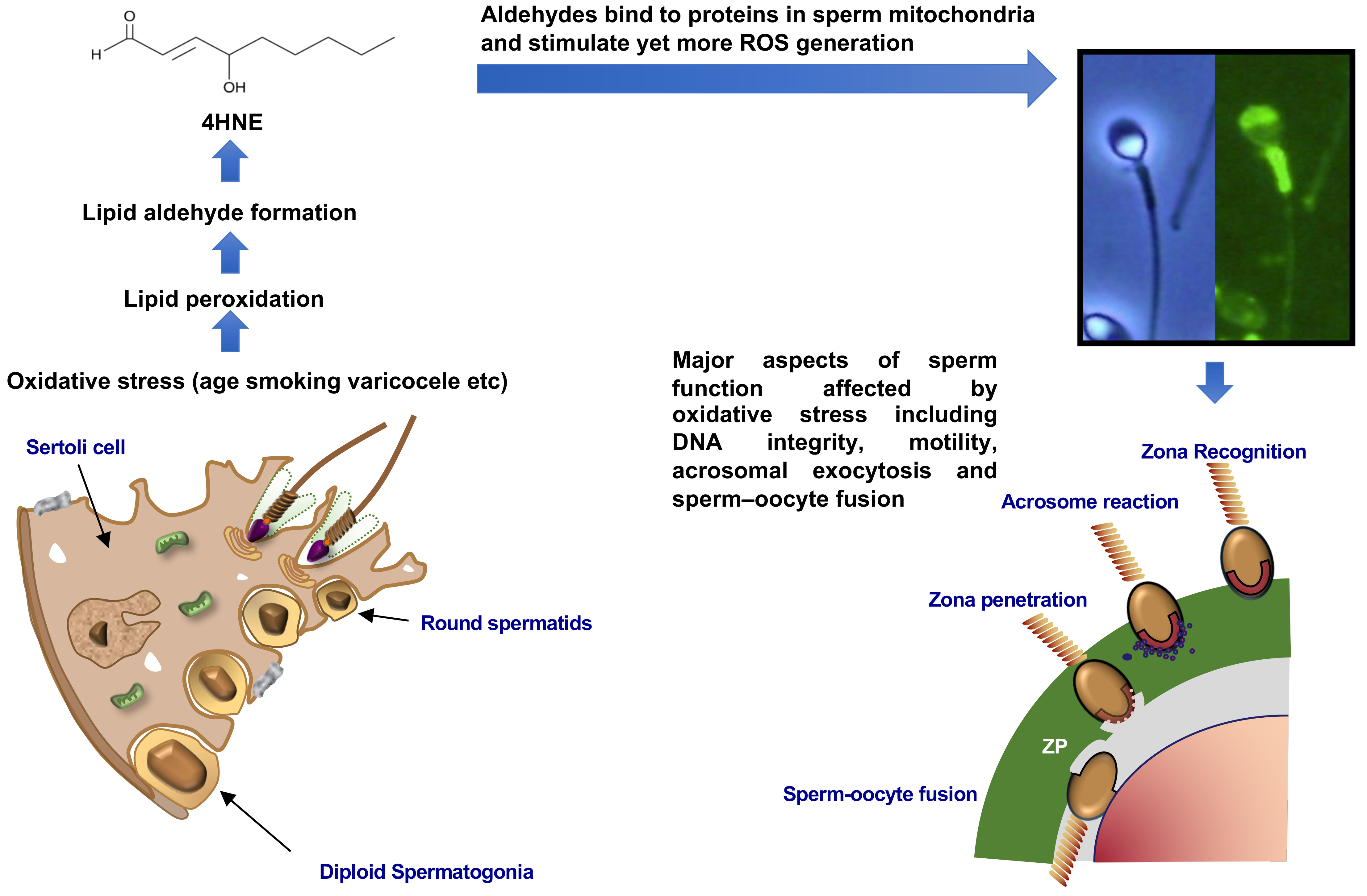 Antioxidants Free FullText The Importance of Oxidative Stress in
