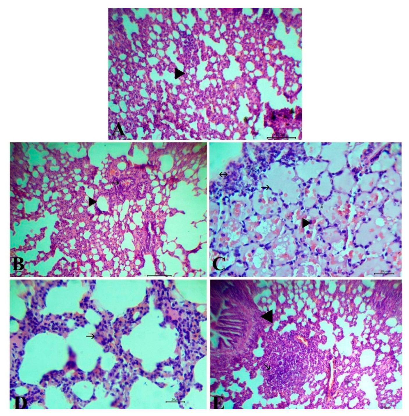 Antioxidants 09 00396 g005 Antioxidants 09 00396 g005