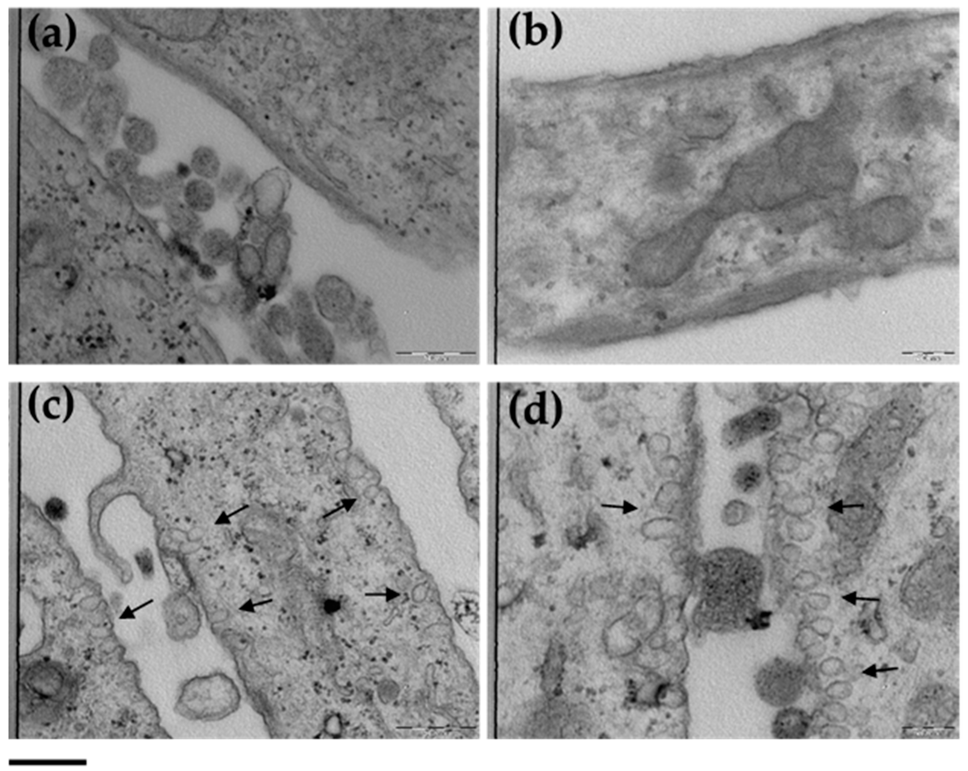 Antioxidants 09 00485 g005