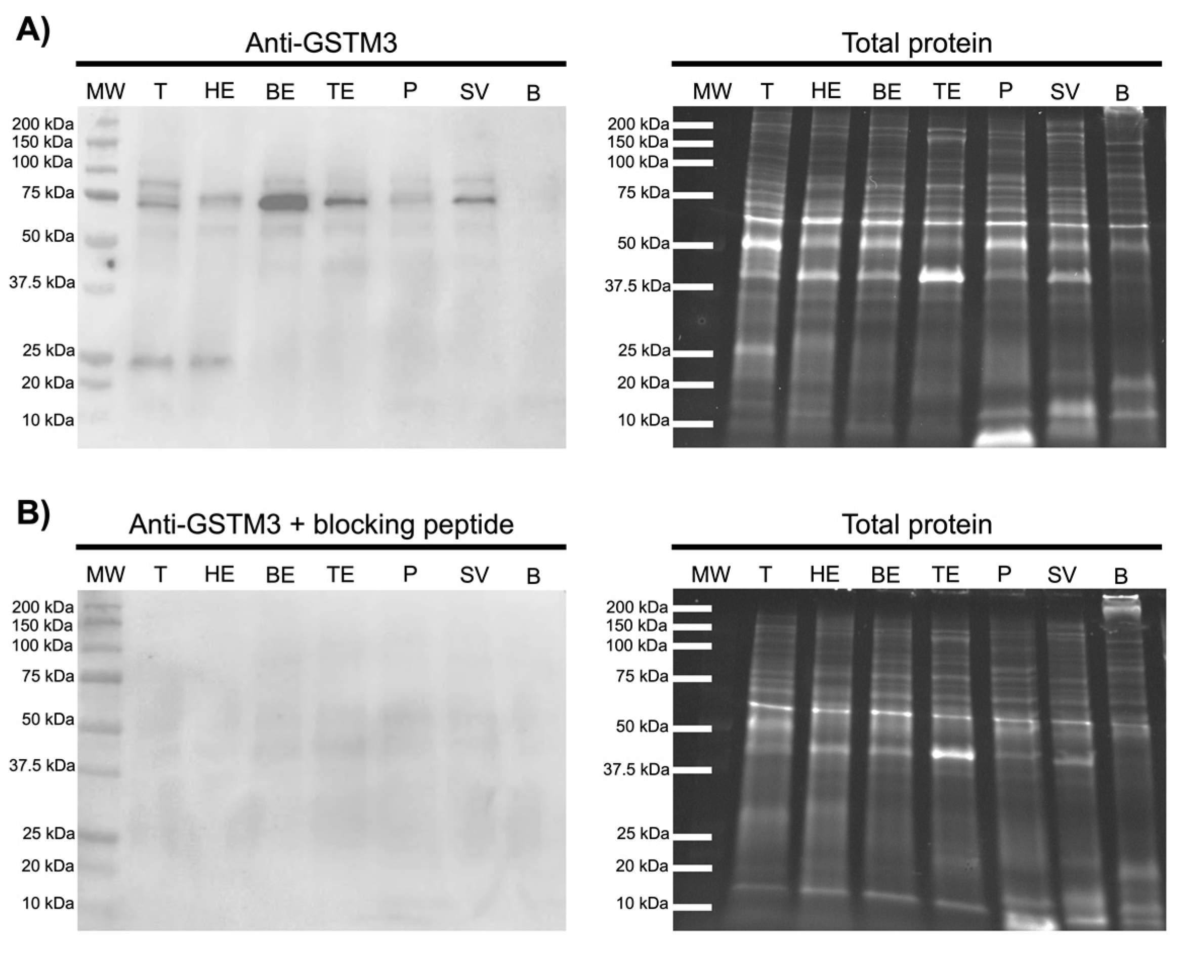 Antioxidants 09 00741 g004