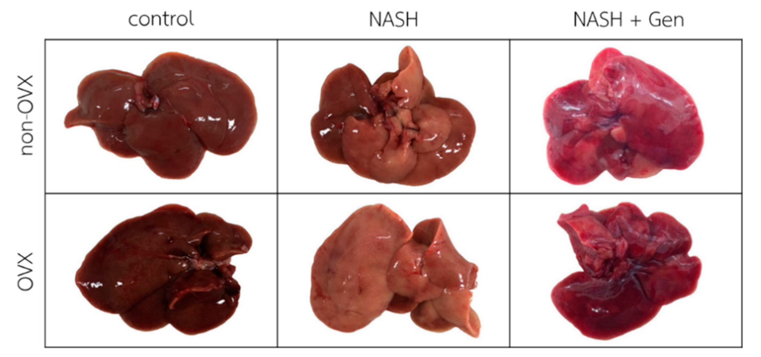 Antioxidants Free FullText Genistein Modulated Lipid Metabolism