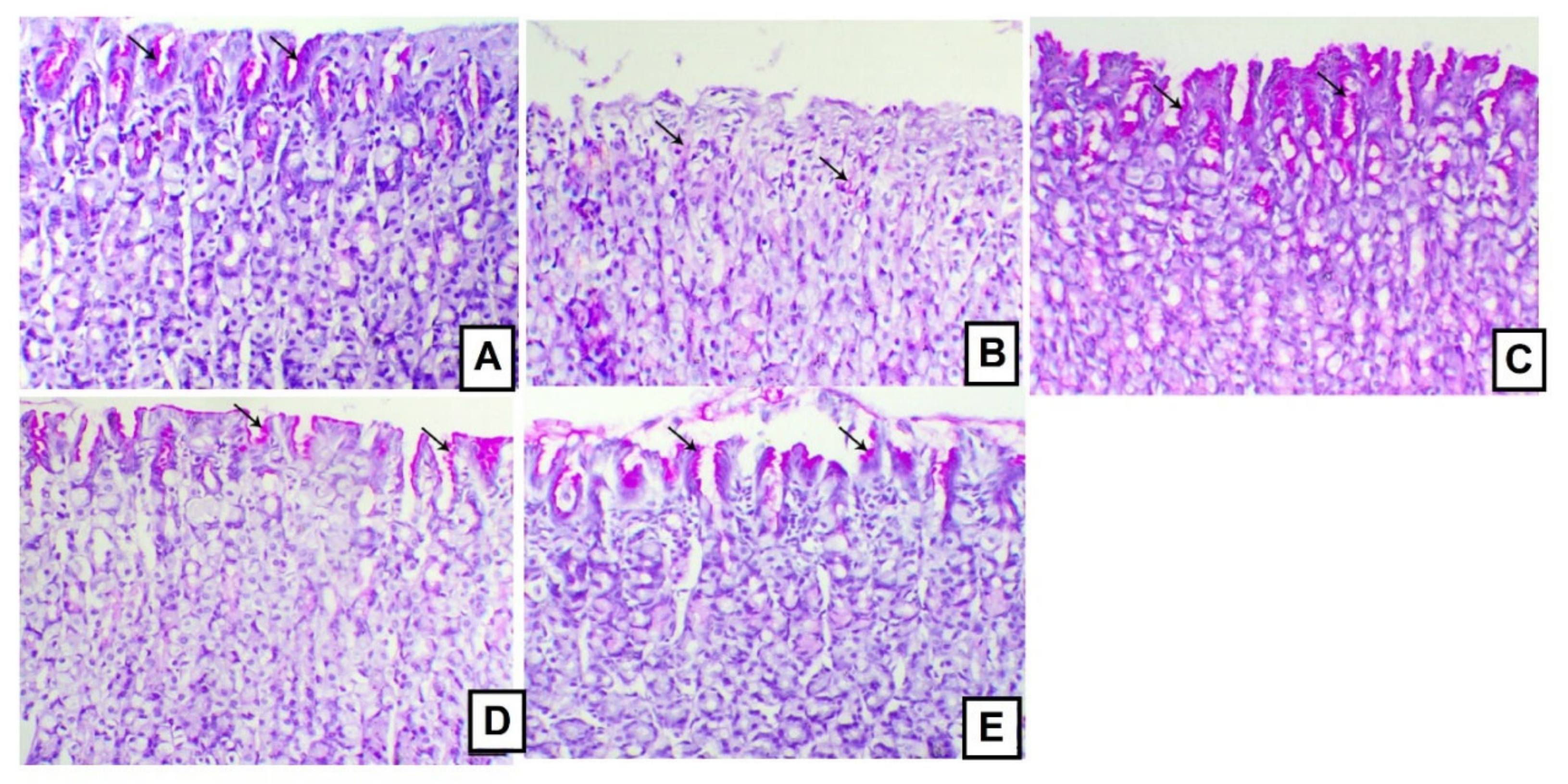 Antioxidants 10 00176 g005