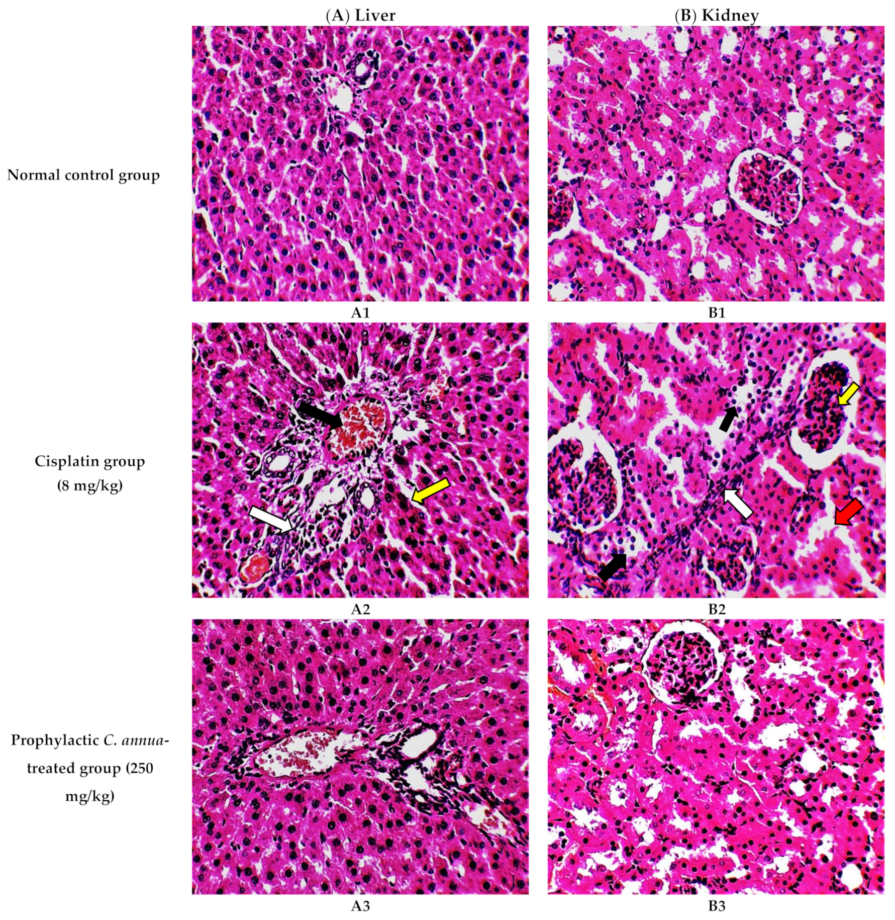 Antioxidants 10 00825 g001 Antioxidants 10 00825 g001