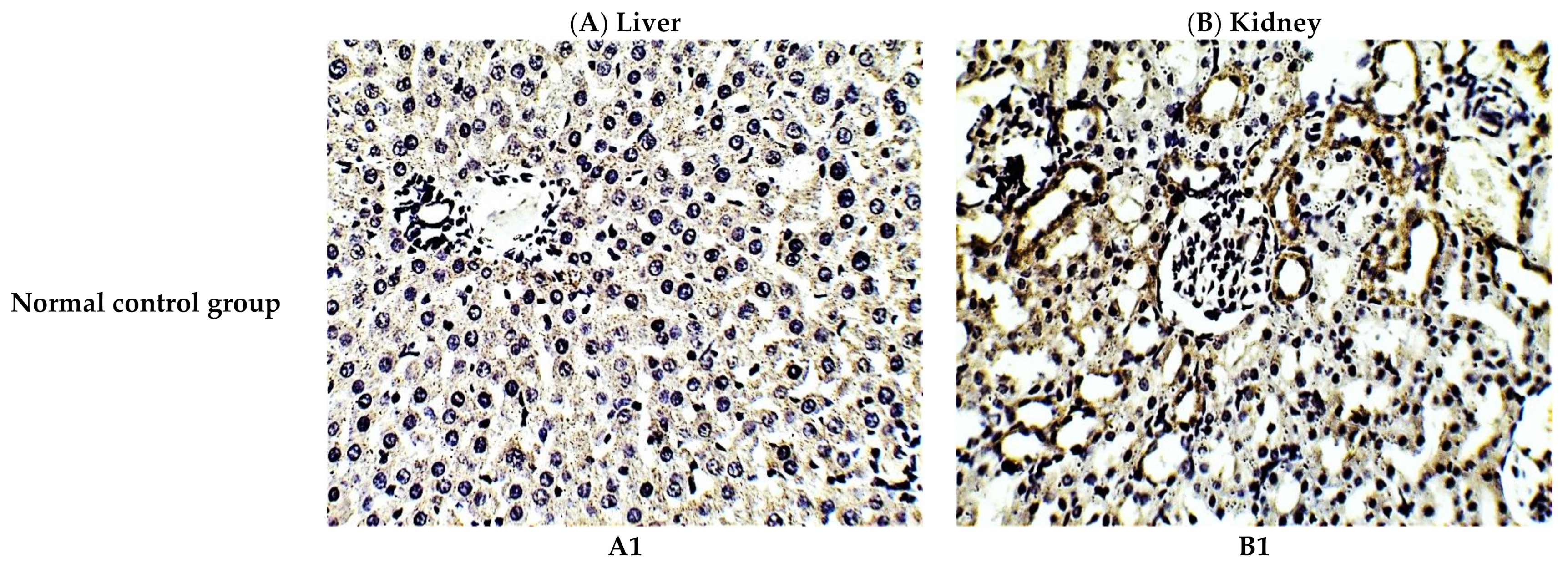 Antioxidants 10 00825 g003a Antioxidants 10 00825 g003a