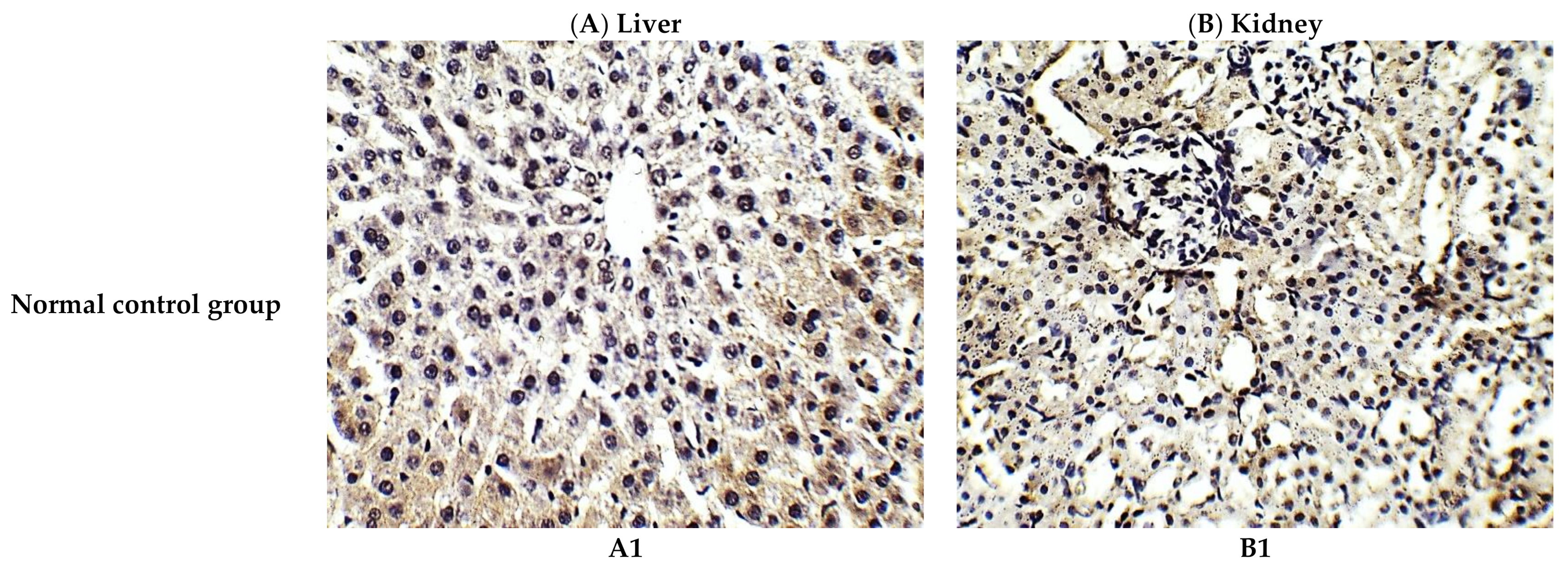 Antioxidants 10 00825 g004a Antioxidants 10 00825 g004a