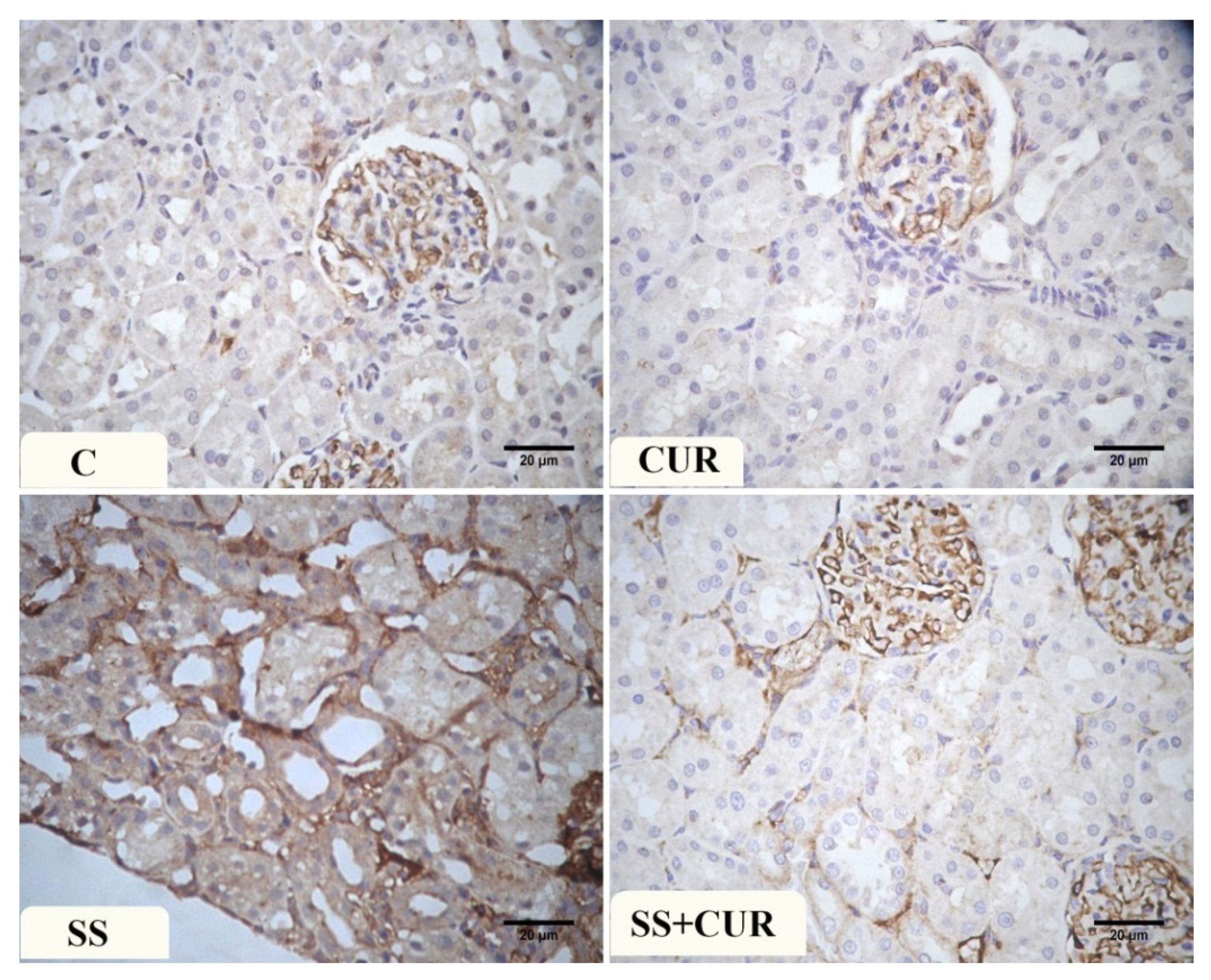 Antioxidants 10 00826 g004