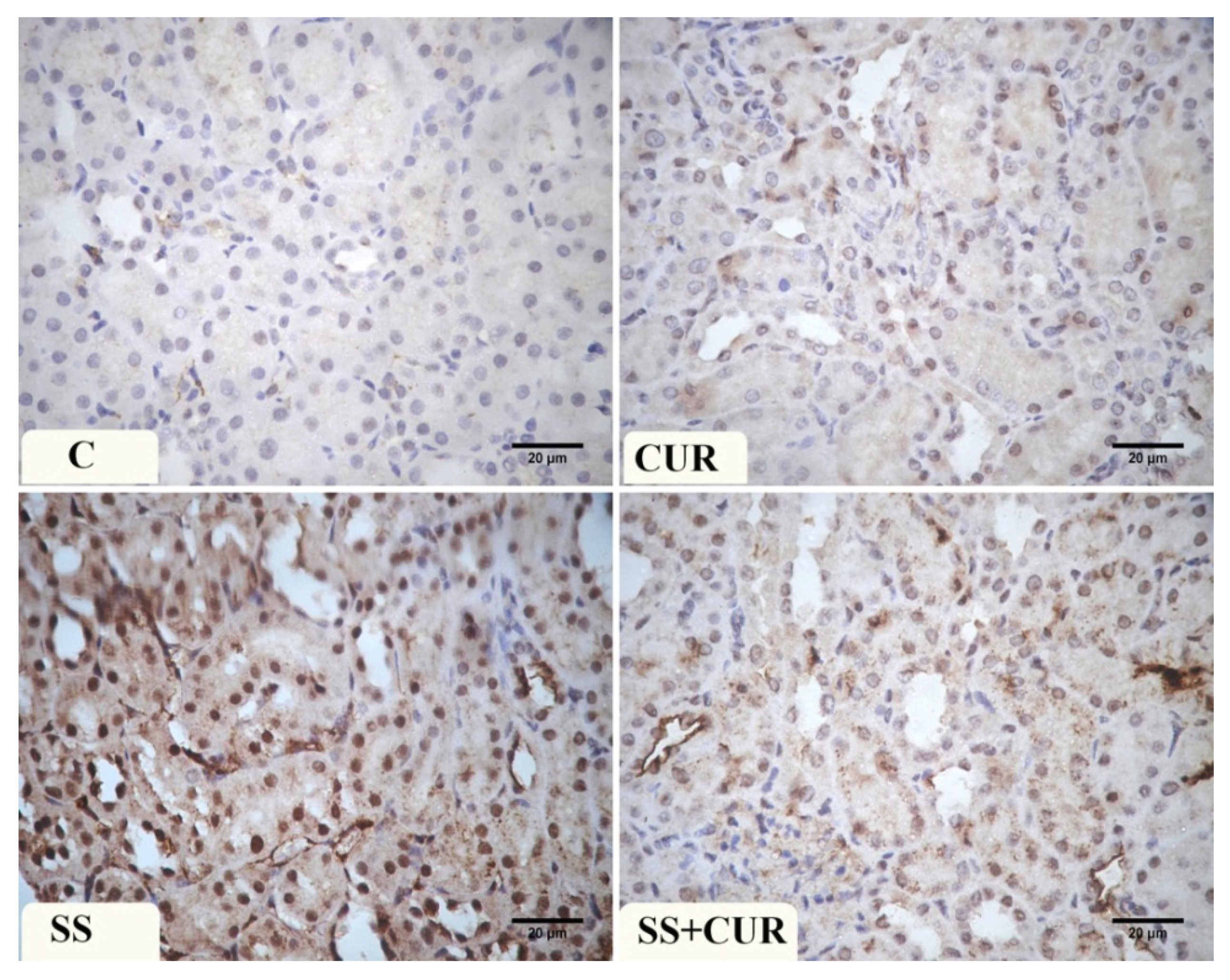 Antioxidants 10 00826 g005