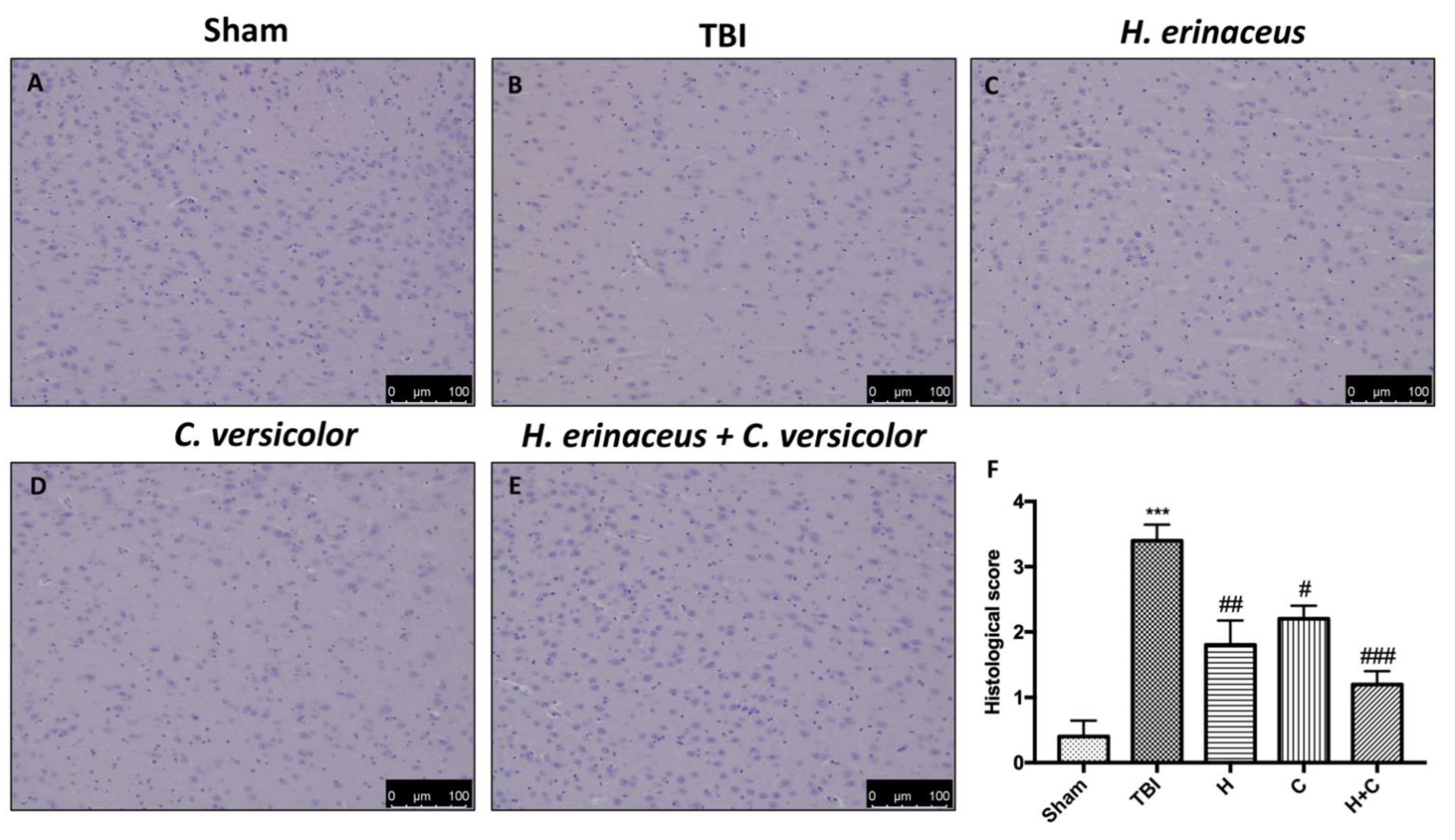 Antioxidants 10 00898 g002 Antioxidants 10 00898 g002
