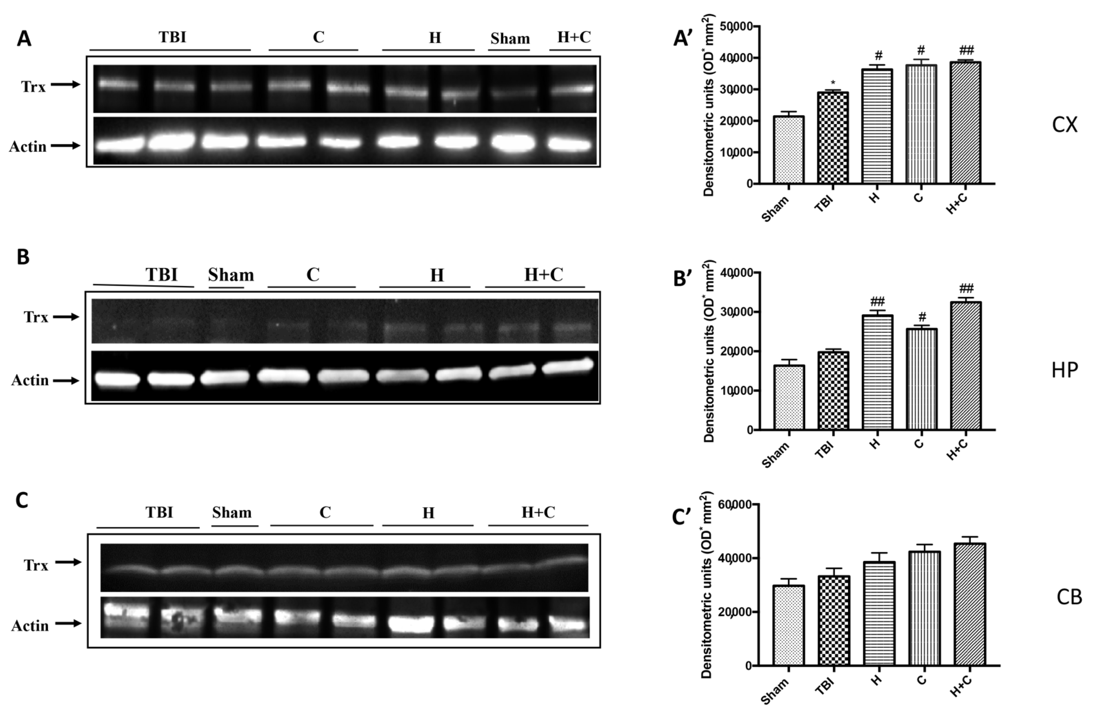 Antioxidants 10 00898 g011 Antioxidants 10 00898 g011
