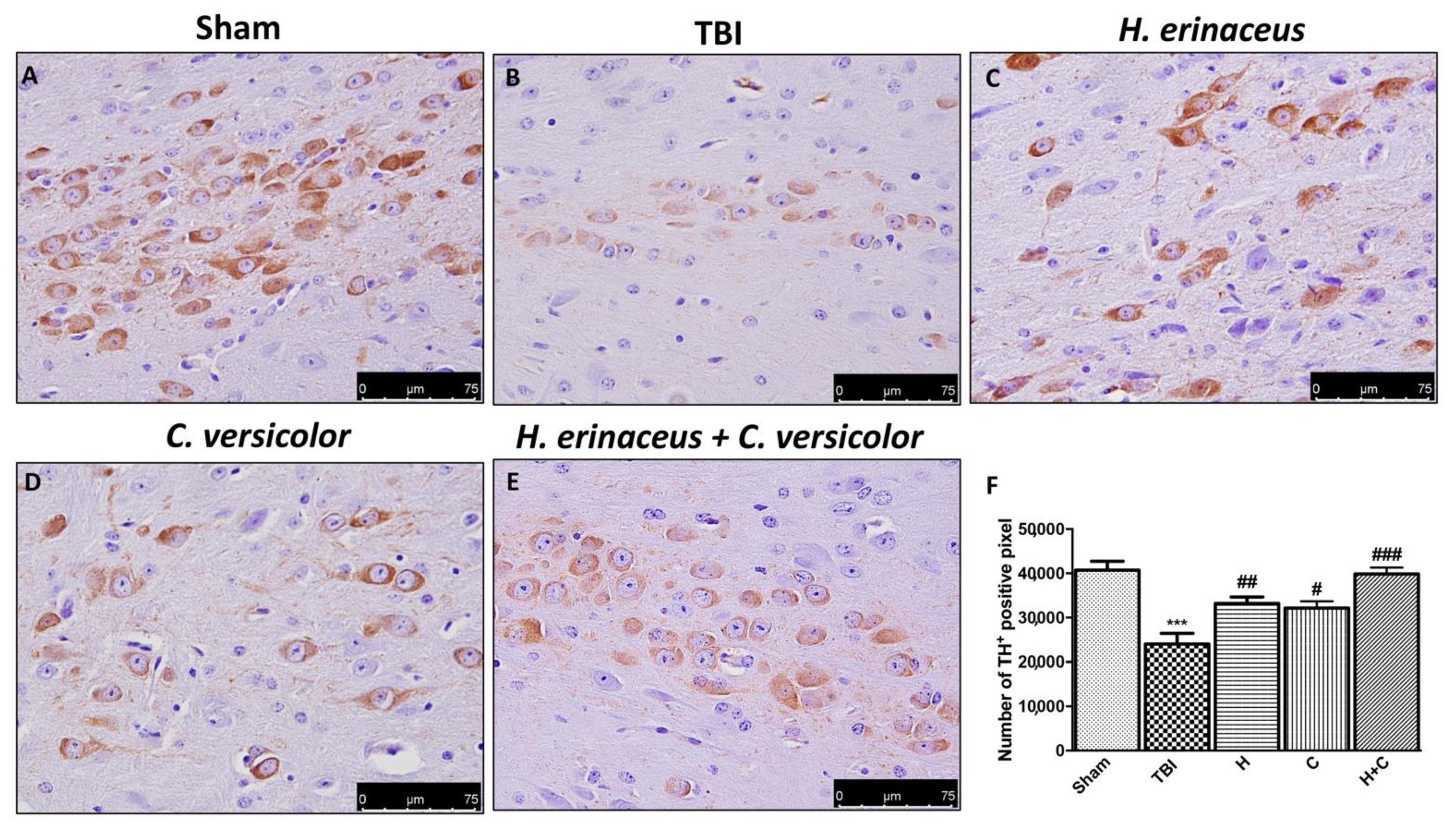 Antioxidants 10 00898 g012 Antioxidants 10 00898 g012