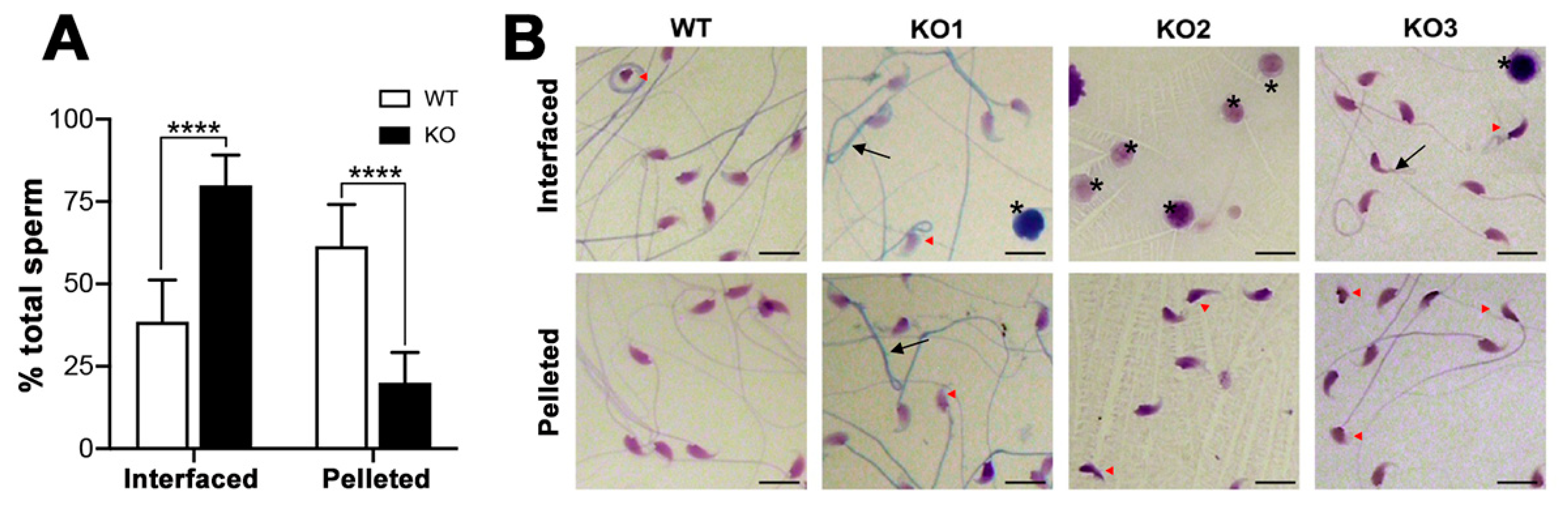 Antioxidants 10 00912 g011