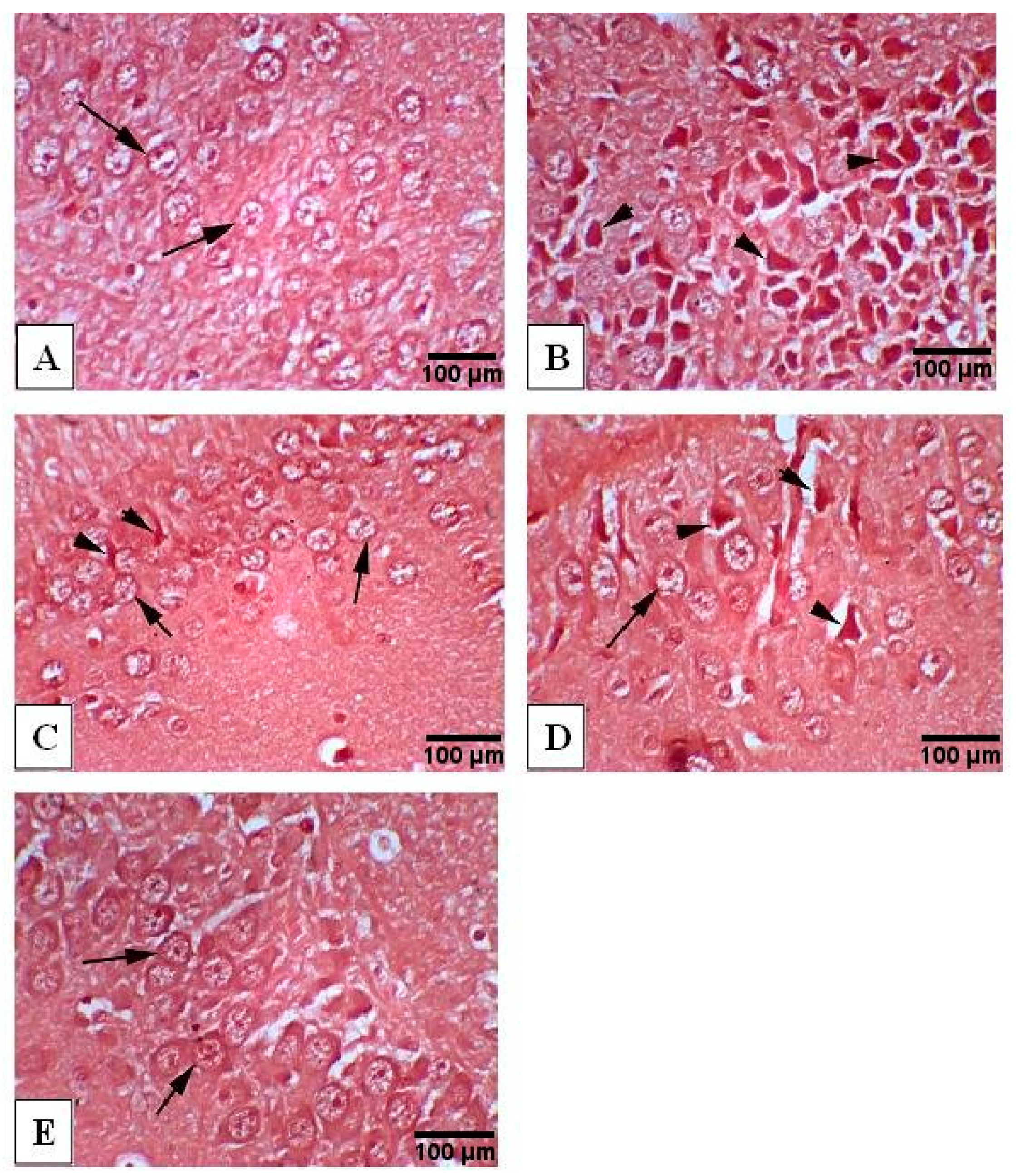 Antioxidants 10 00947 g007