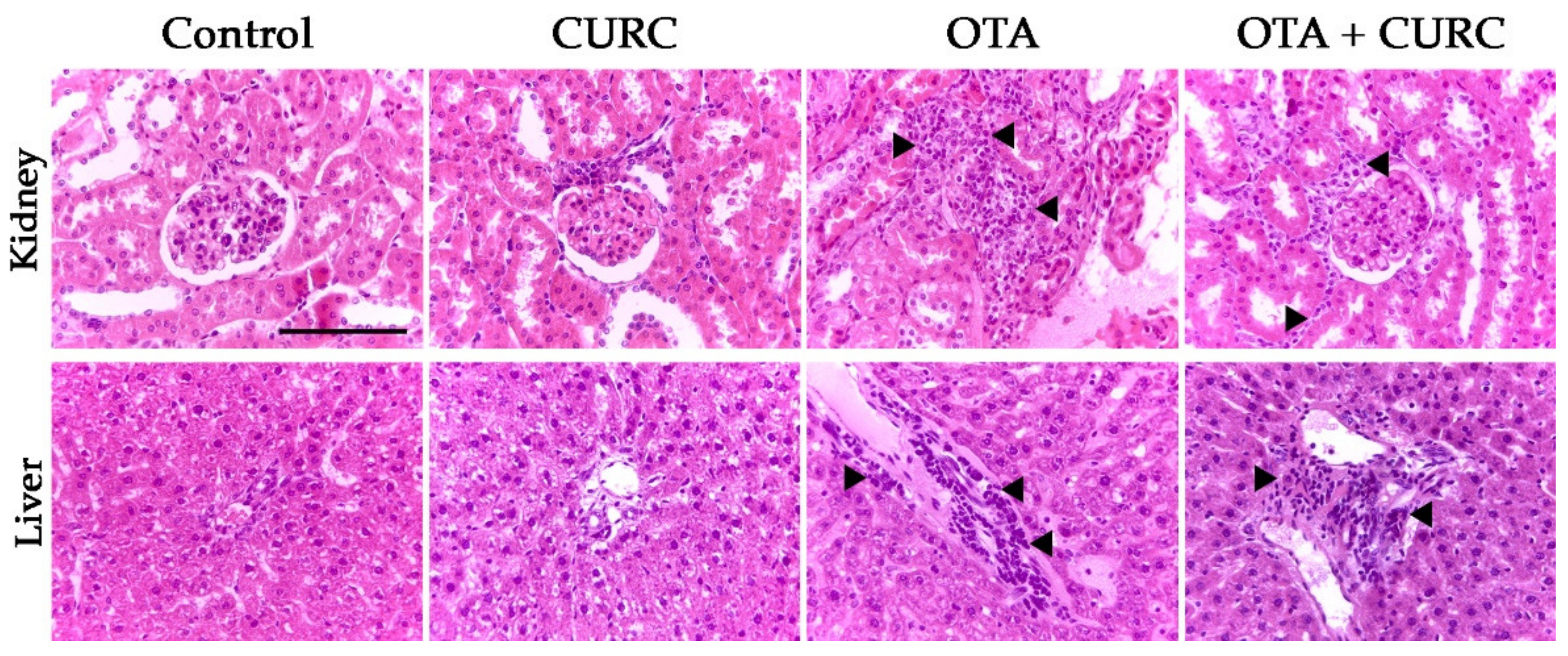 Antioxidants 10 01239 g009