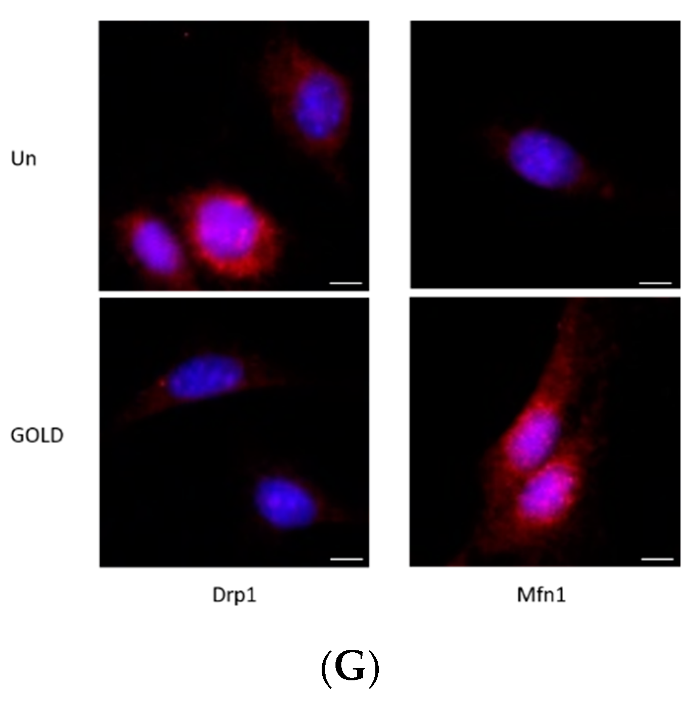 Antioxidants 10 01486 g005b