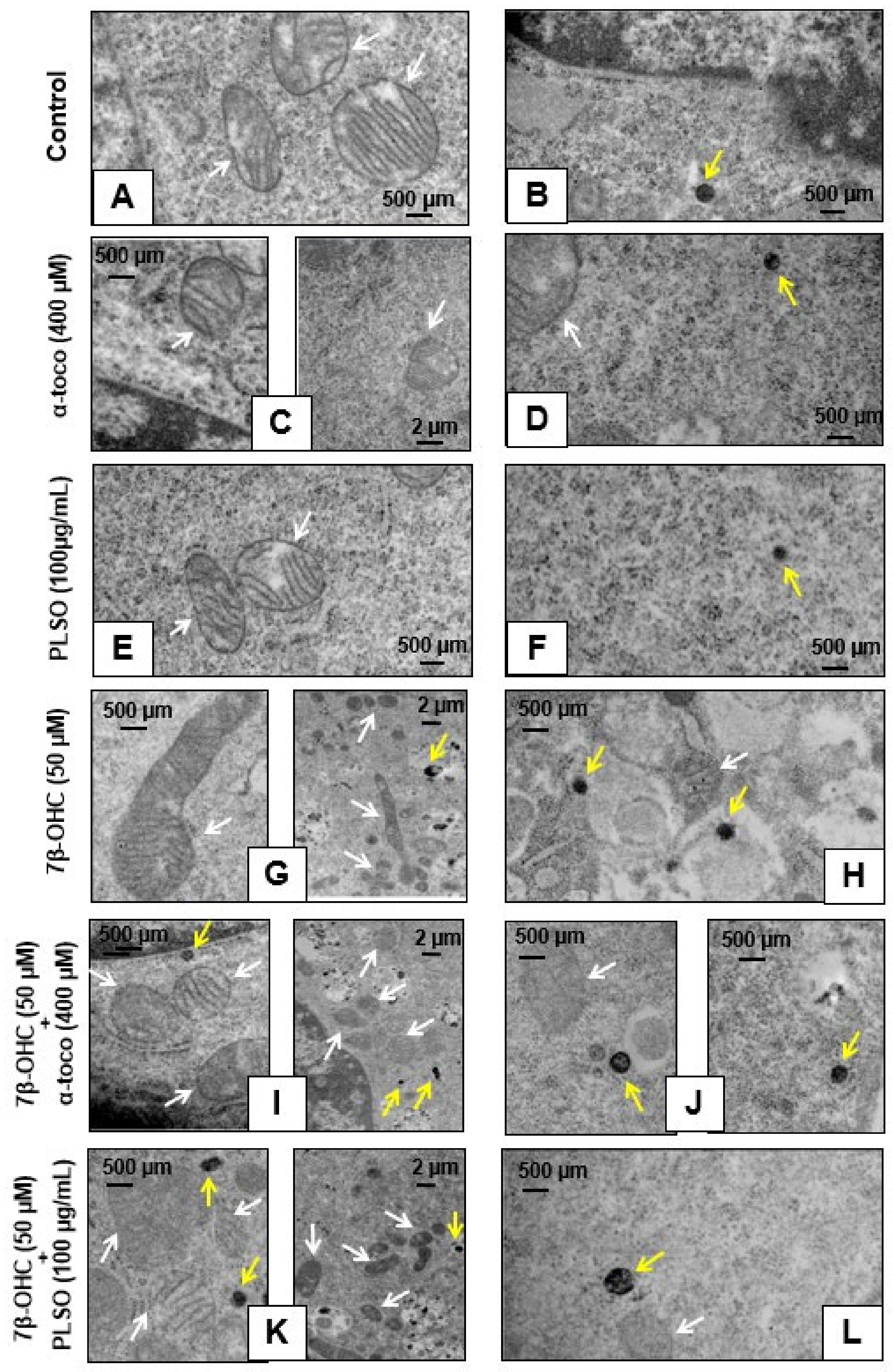 Antioxidants 10 01772 g010 Antioxidants 10 01772 g010