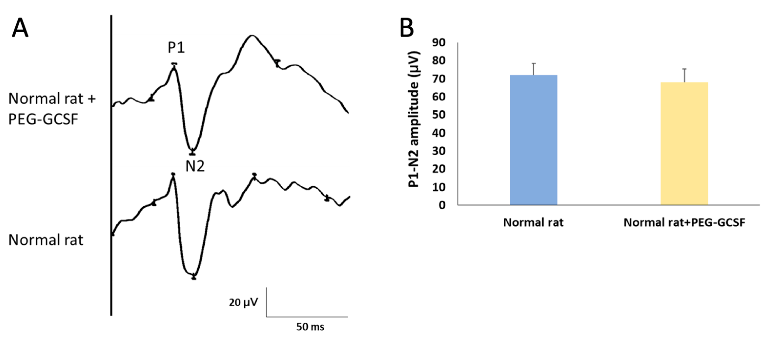 Antioxidants Free FullText Intravitreal Injection of LongActing