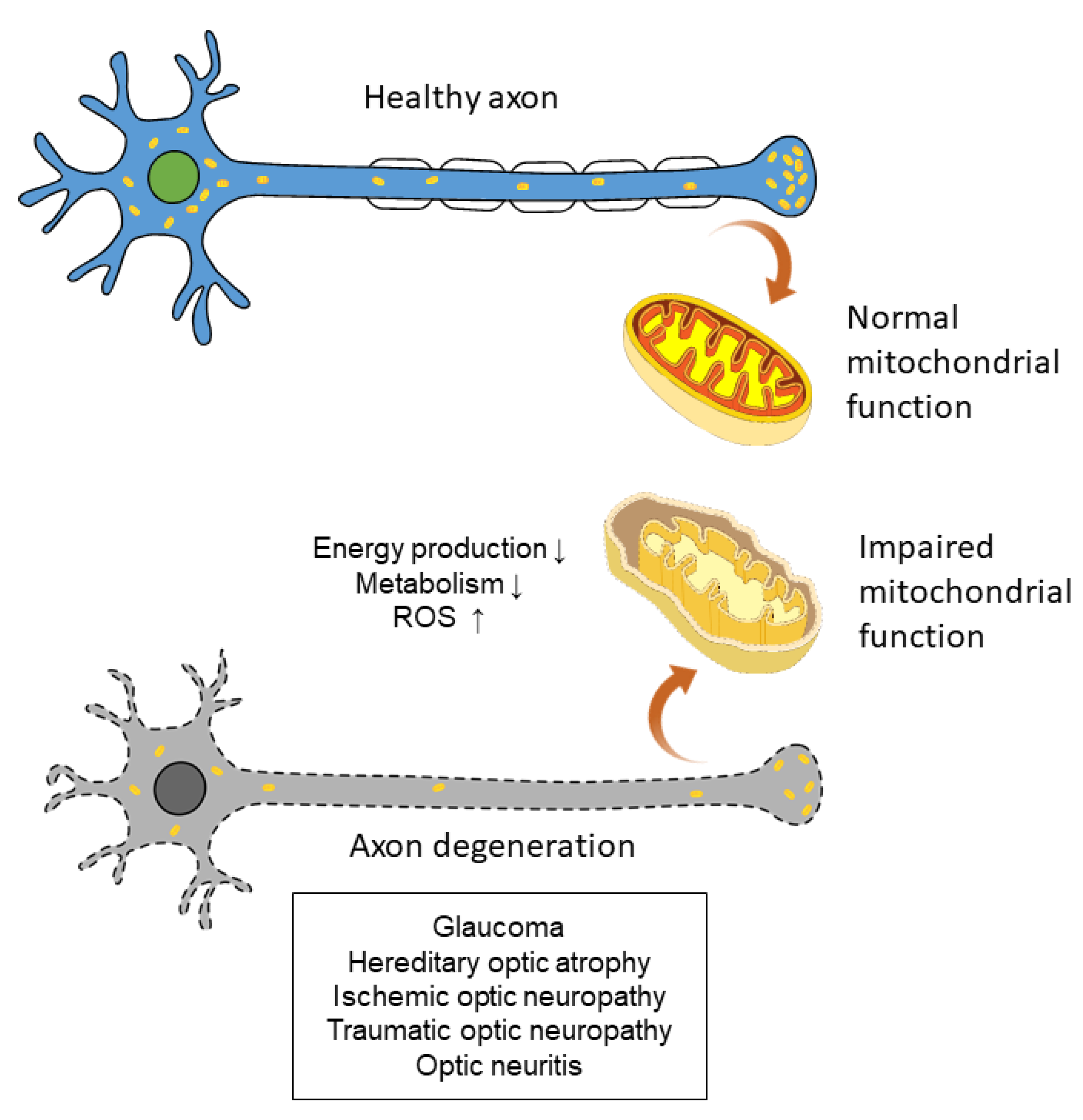 Antioxidants | Free Full-Text | Role of Oxidative Stress in Ocular Diseases Associated with Ganglion Cells Degeneration