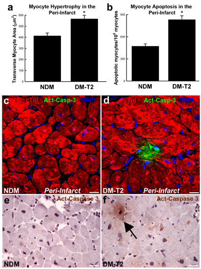 Unraveling and Targeting Myocardial Regeneration Deficit in