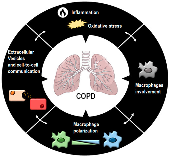 Antioxidants Free FullText The Emerging Role of Macrophages in