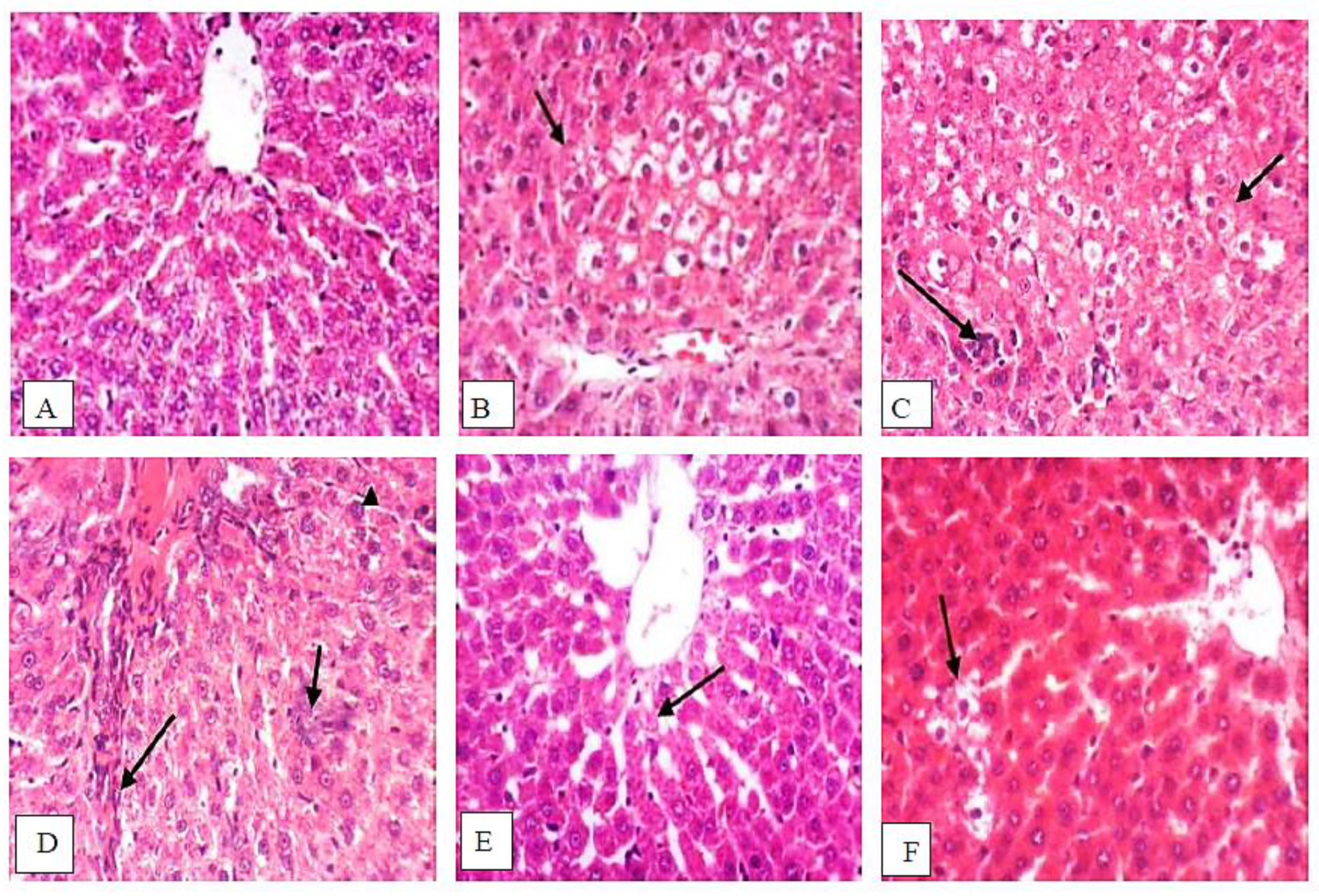 Antioxidants 11 00699 g010