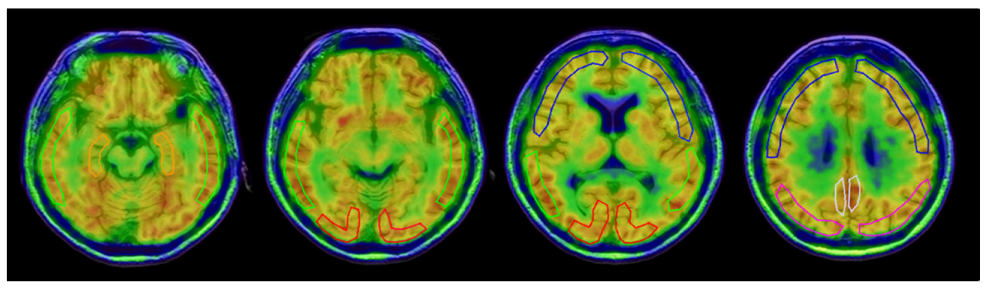 Antioxidants 11 01022 g002 550