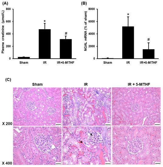 Antioxidants Free FullText 5Methyltetrahydrofolate Attenuates