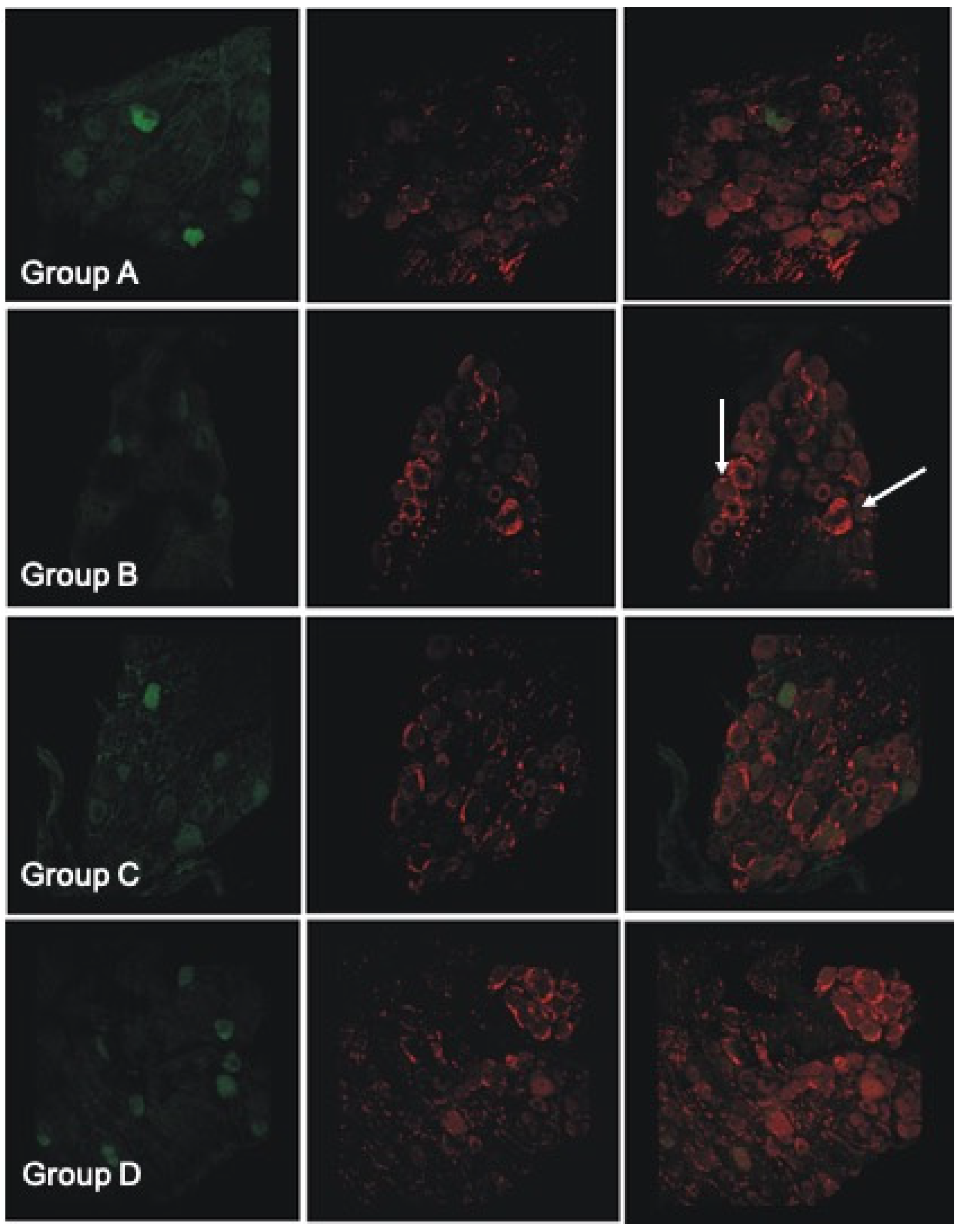 Antioxidants 11 01062 g006 Antioxidants 11 01062 g006