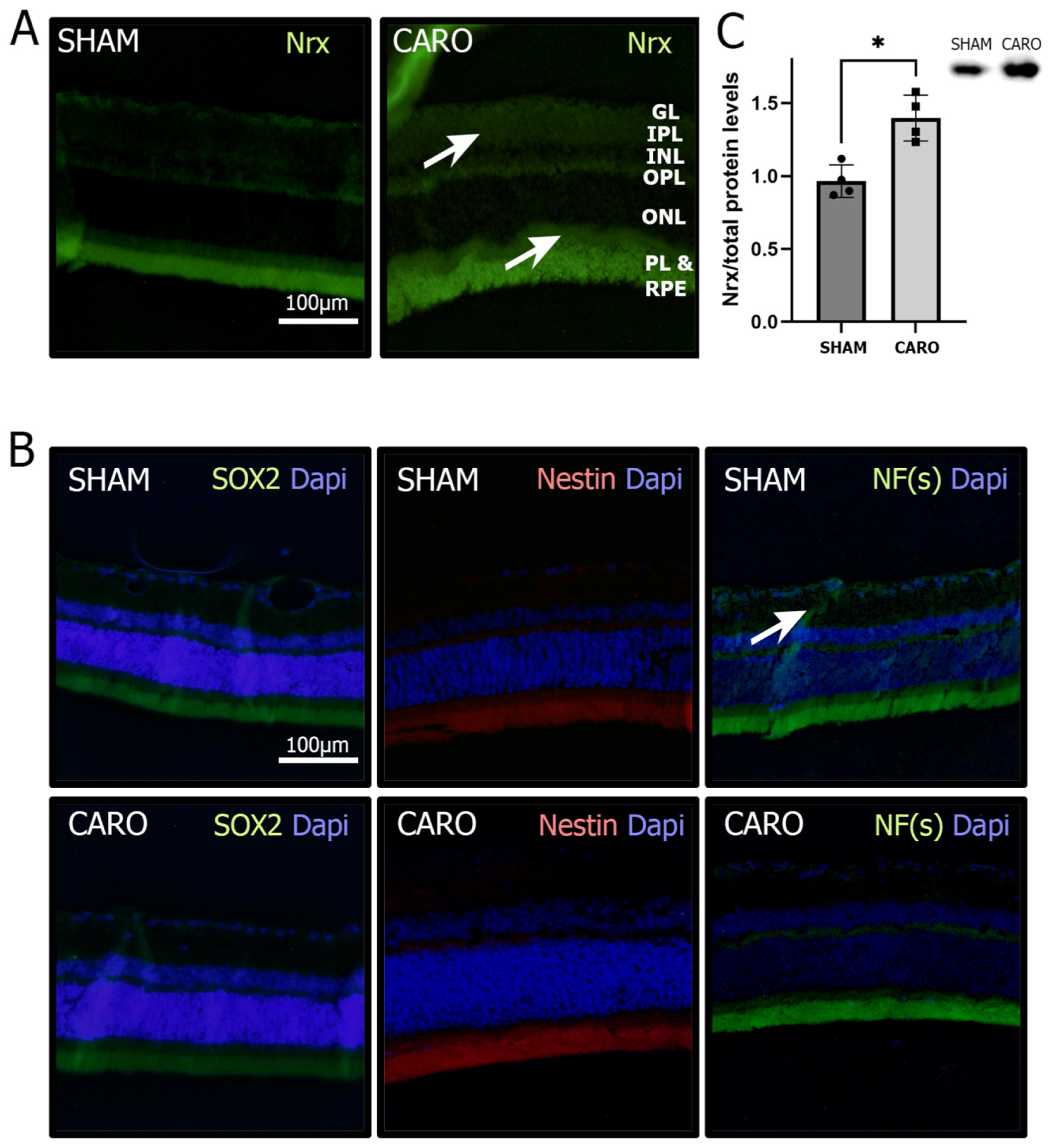 Antioxidants 11 01106 g001 550