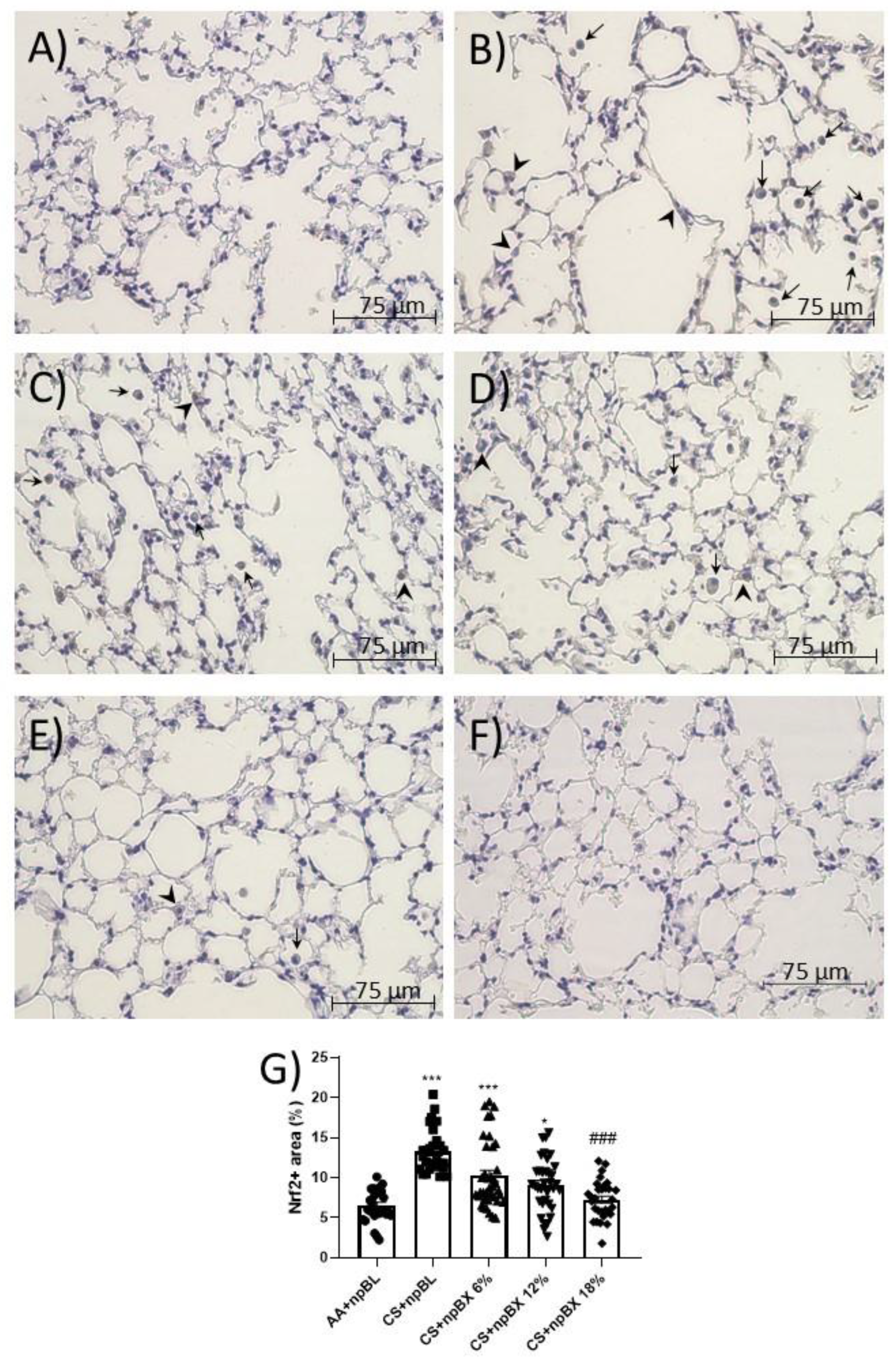 Antioxidants 11 01293 g008