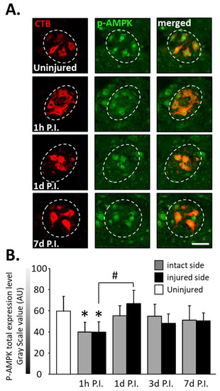AMPK-Nrf2 Signaling Pathway in Phrenic Motoneurons following
