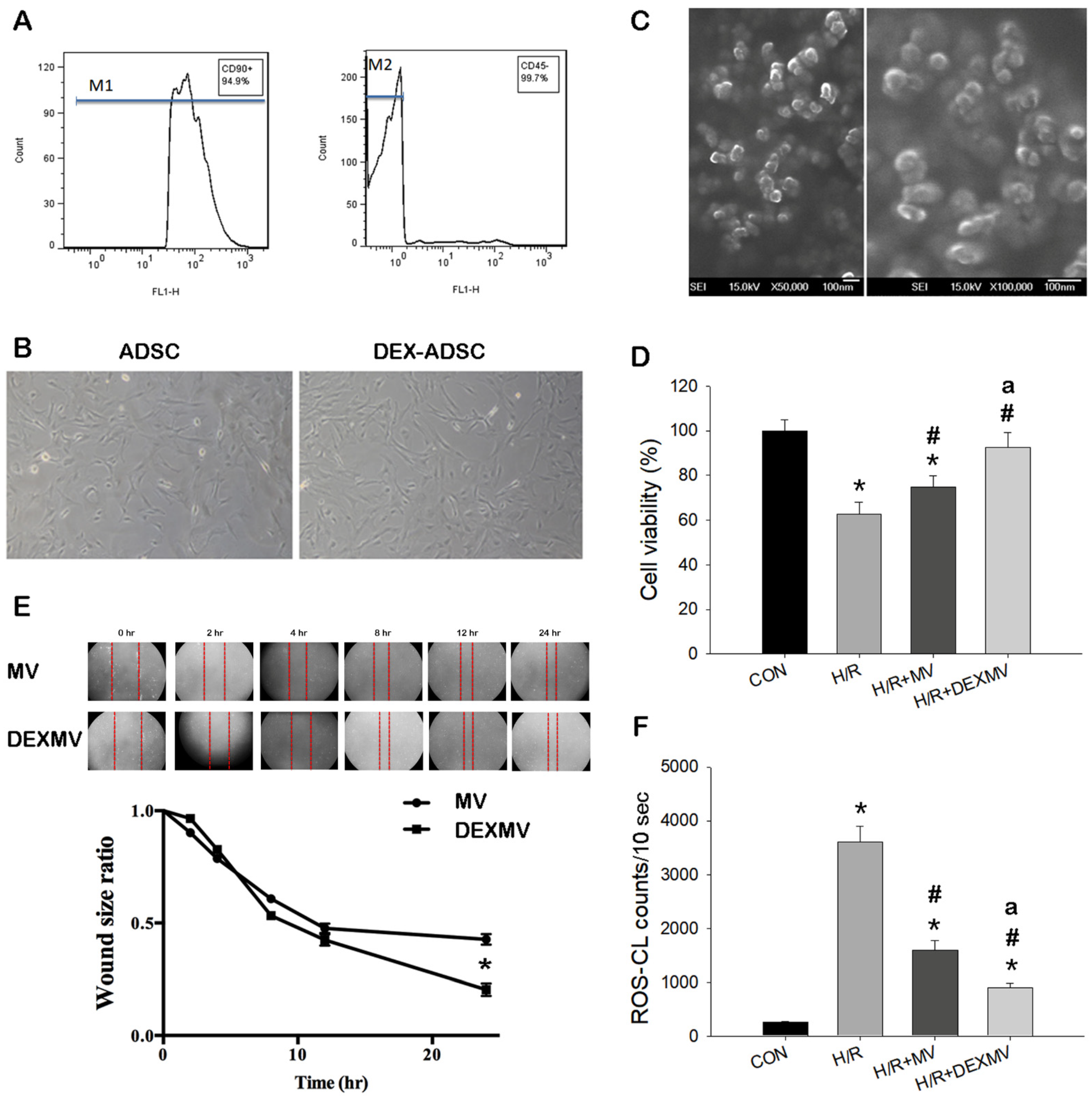 Antioxidants Free Full-Text Intrarenal Arterial Transplantation of  Dexmedetomidine Preconditioning Adipose Stem-Cell-Derived Microvesicles  Confers Further Therapeutic Potential to Attenuate Renal  Ischemia/Reperfusion Injury through miR-122-5p ...