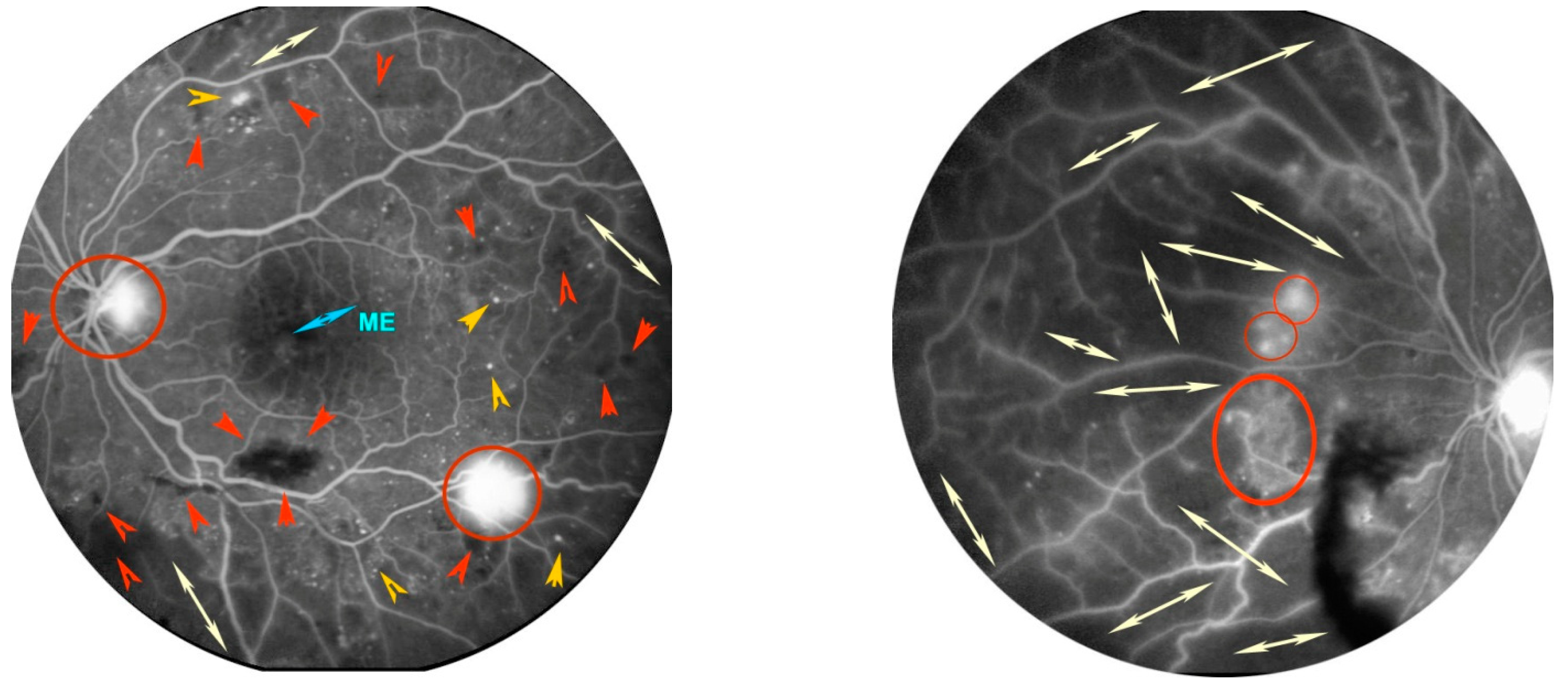 Antioxidants 11 01790 g003 Antioxidants 11 01790 g003