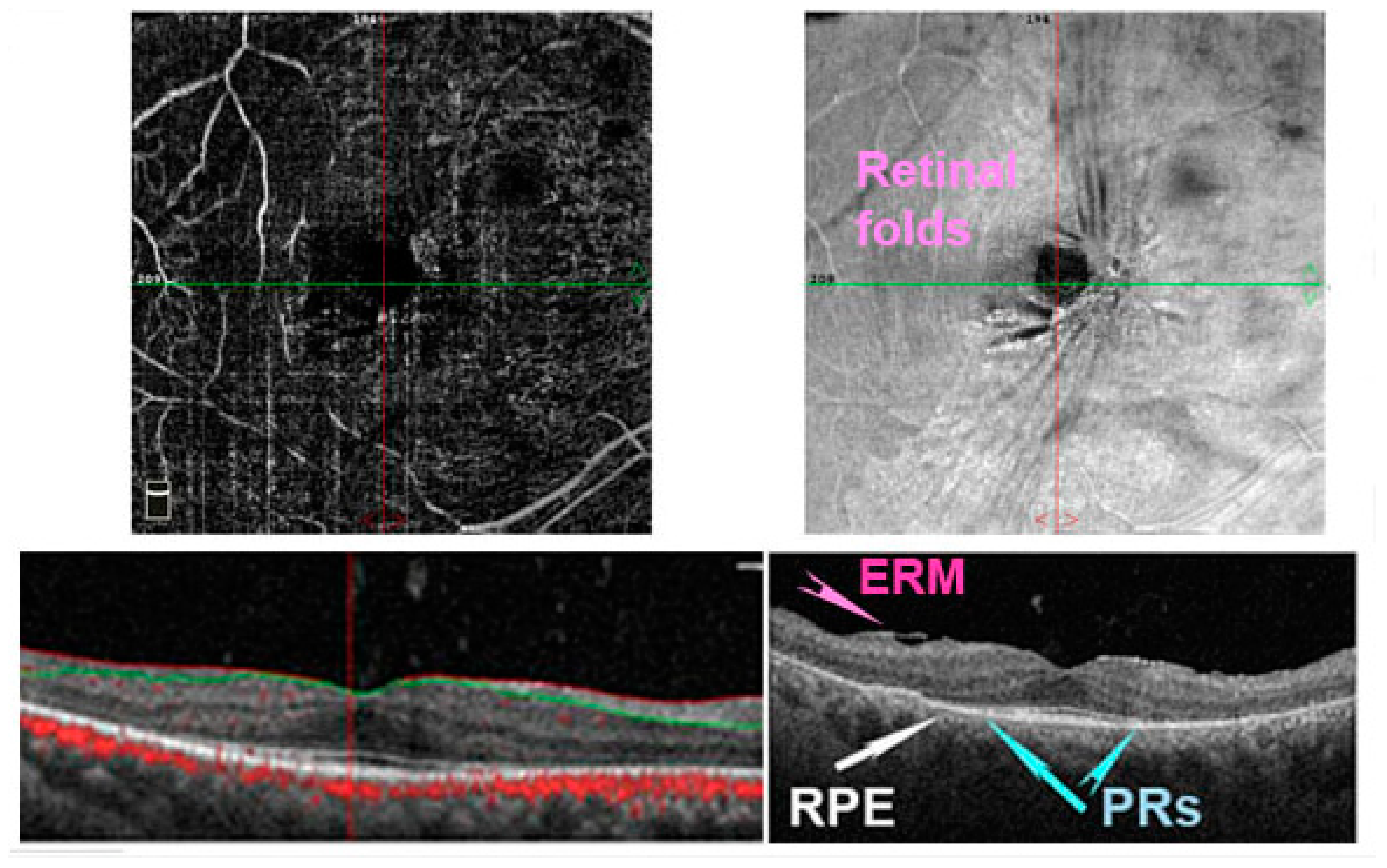 Antioxidants 11 01790 g005 Antioxidants 11 01790 g005