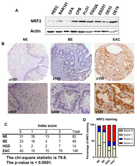Targeting NRF2 Sensitizes Esophageal Adenocarcinoma Cells to