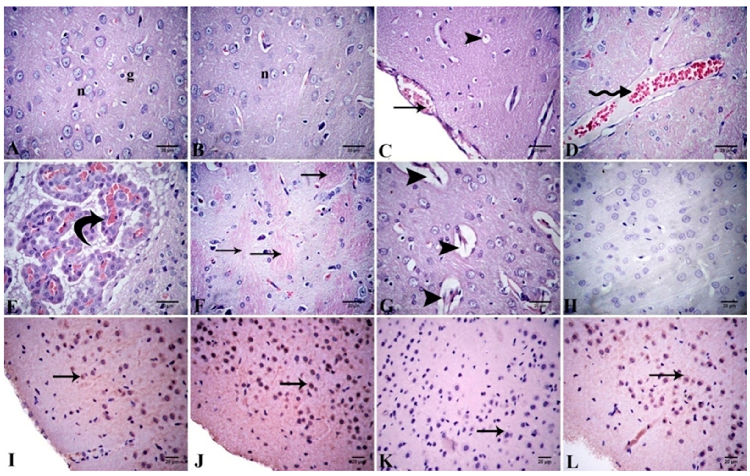 Antioxidants 11 01992 g006 Antioxidants 11 01992 g006