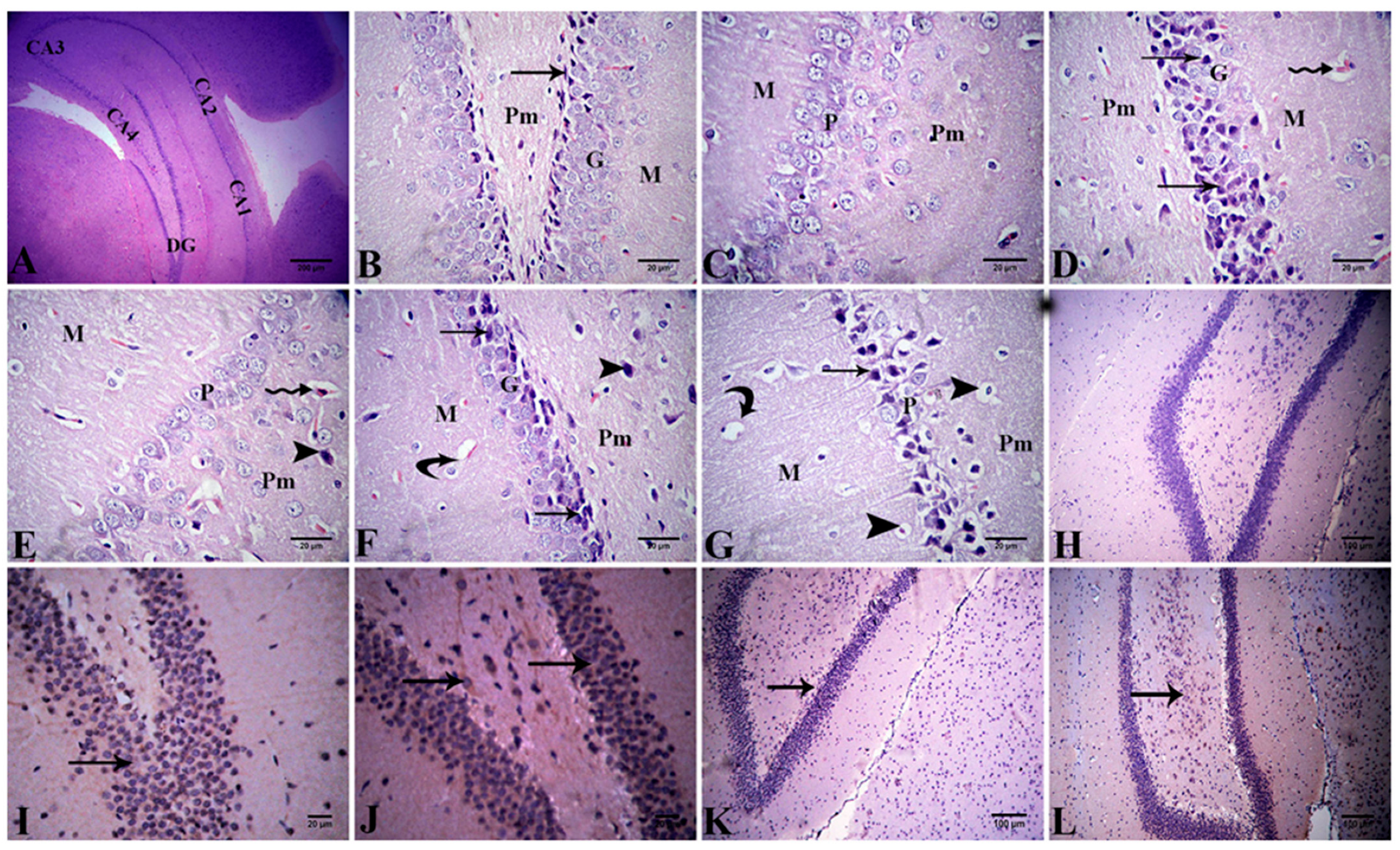 Antioxidants 11 01992 g008 Antioxidants 11 01992 g008