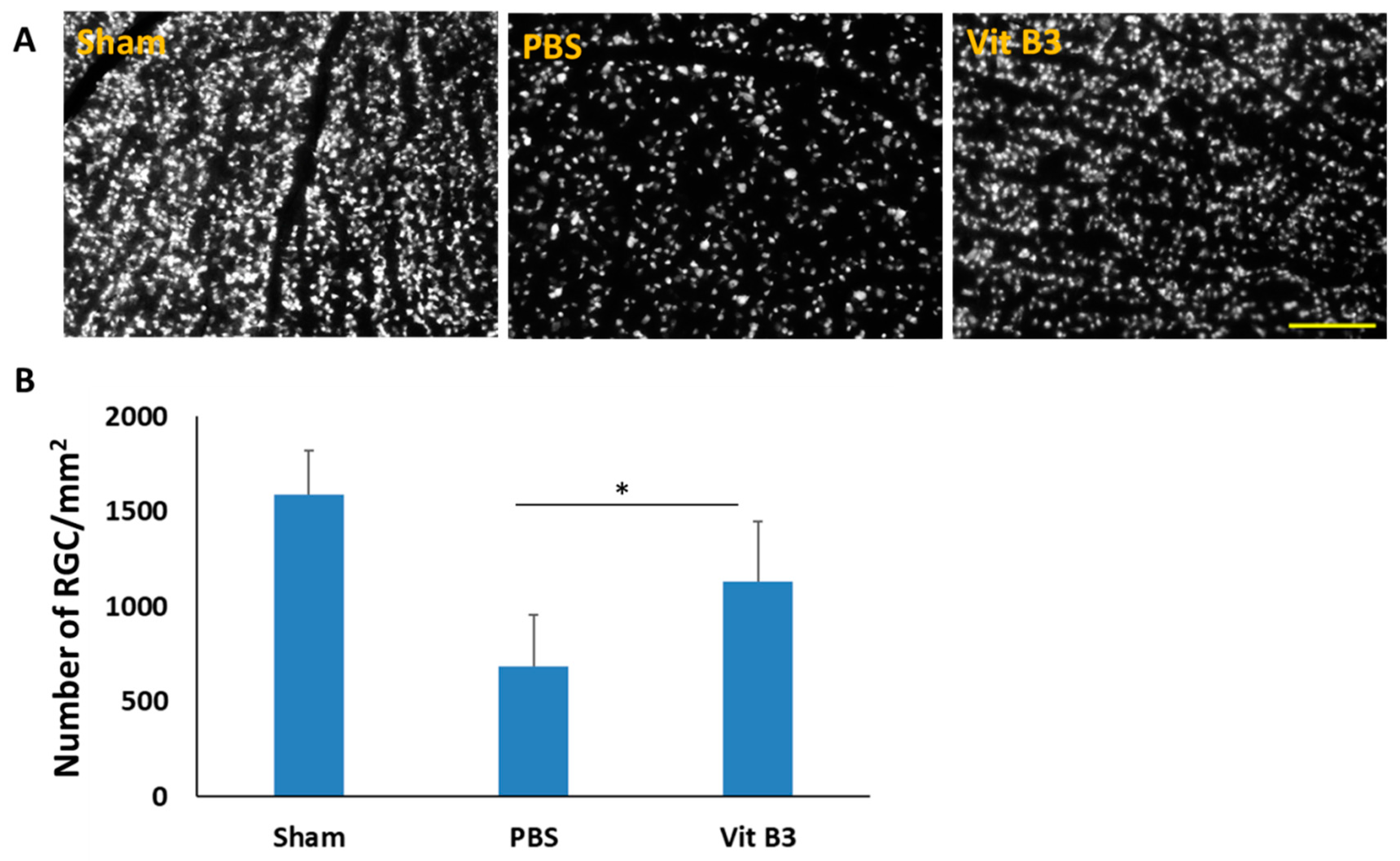 Antioxidants 11 02422 g002 Antioxidants 11 02422 g002