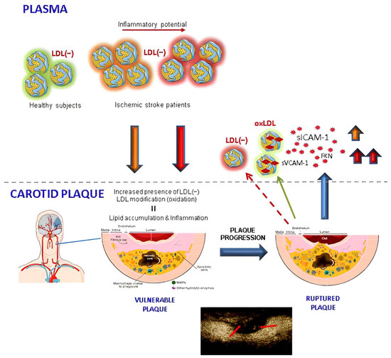 Antioxidants Free FullText Electronegative LDL Is Associated with
