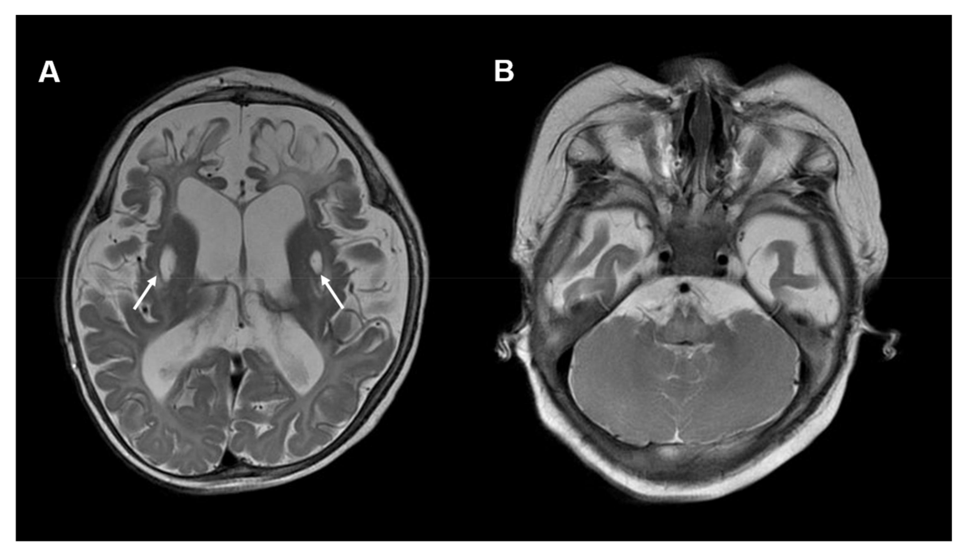 Antioxidants 12 00718 g004 Antioxidants 12 00718 g004
