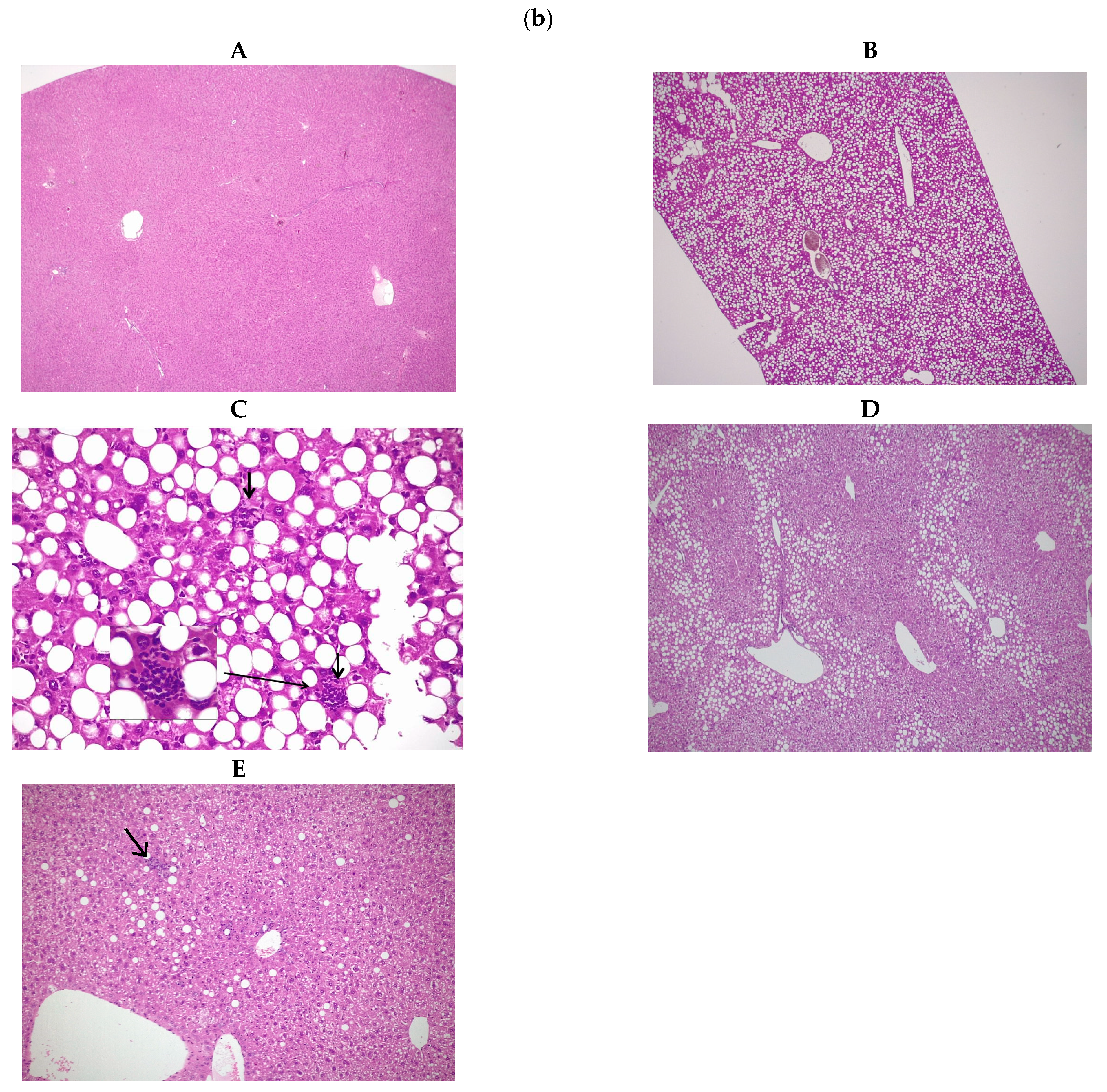 Antioxidants 12 00971 g001b