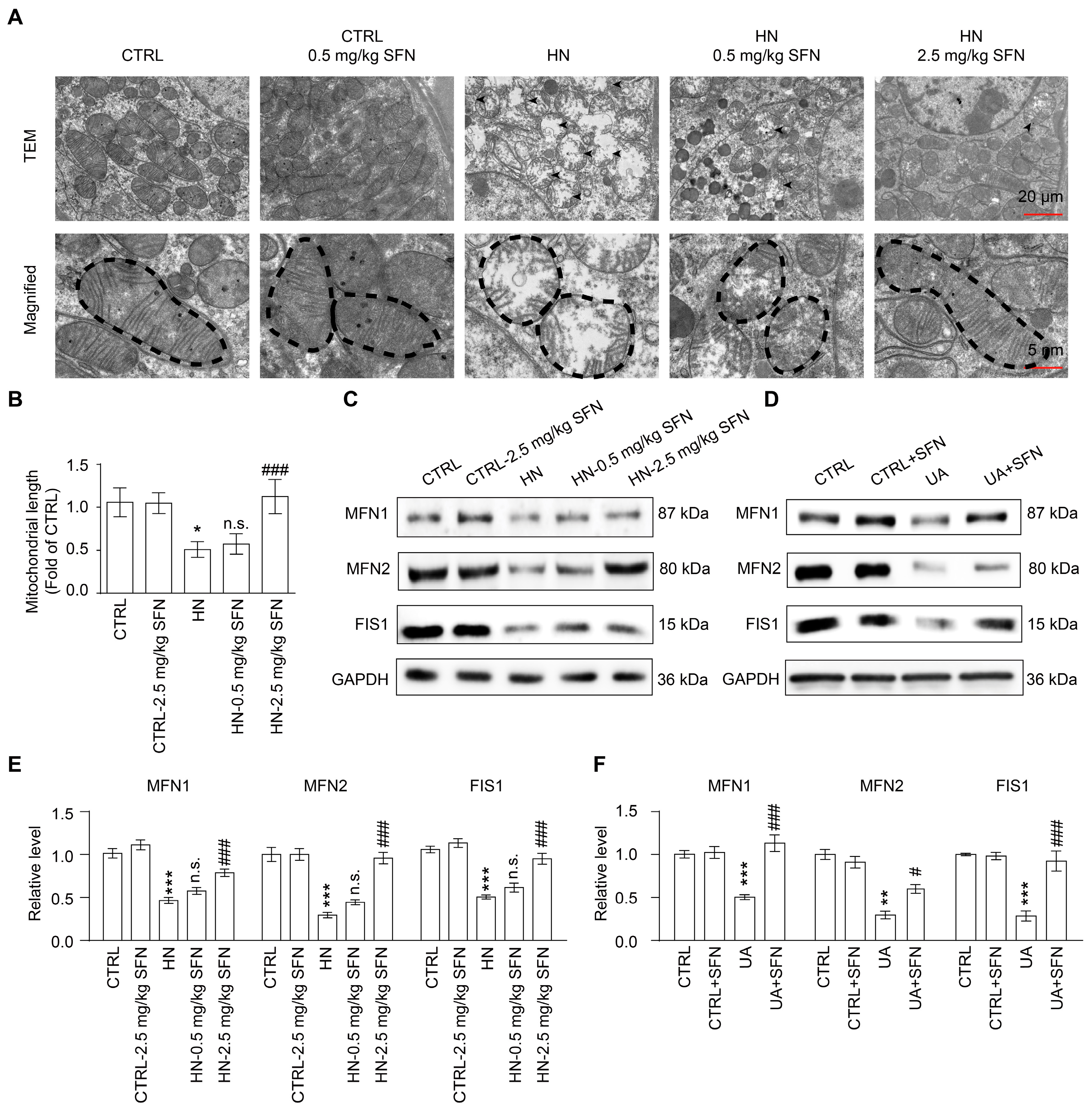 Antioxidants 12 01022 g006 Antioxidants 12 01022 g006