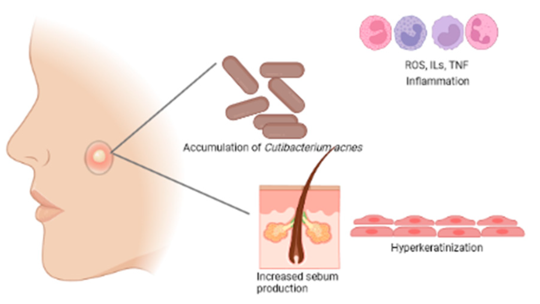 Turpentine Oil: Exploring Benefits and Side Effects