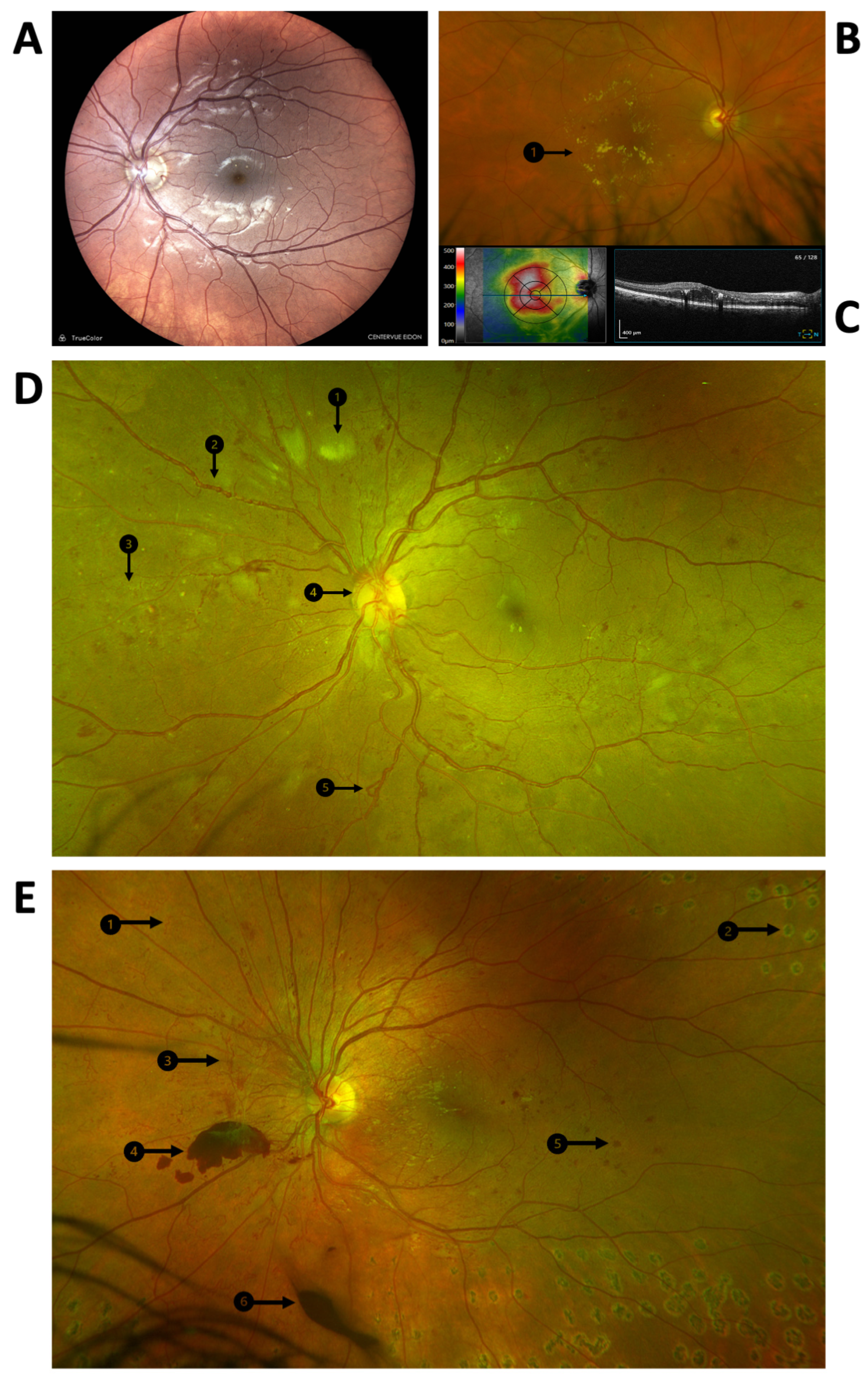 Antioxidants 12 01649 g001 Antioxidants 12 01649 g001