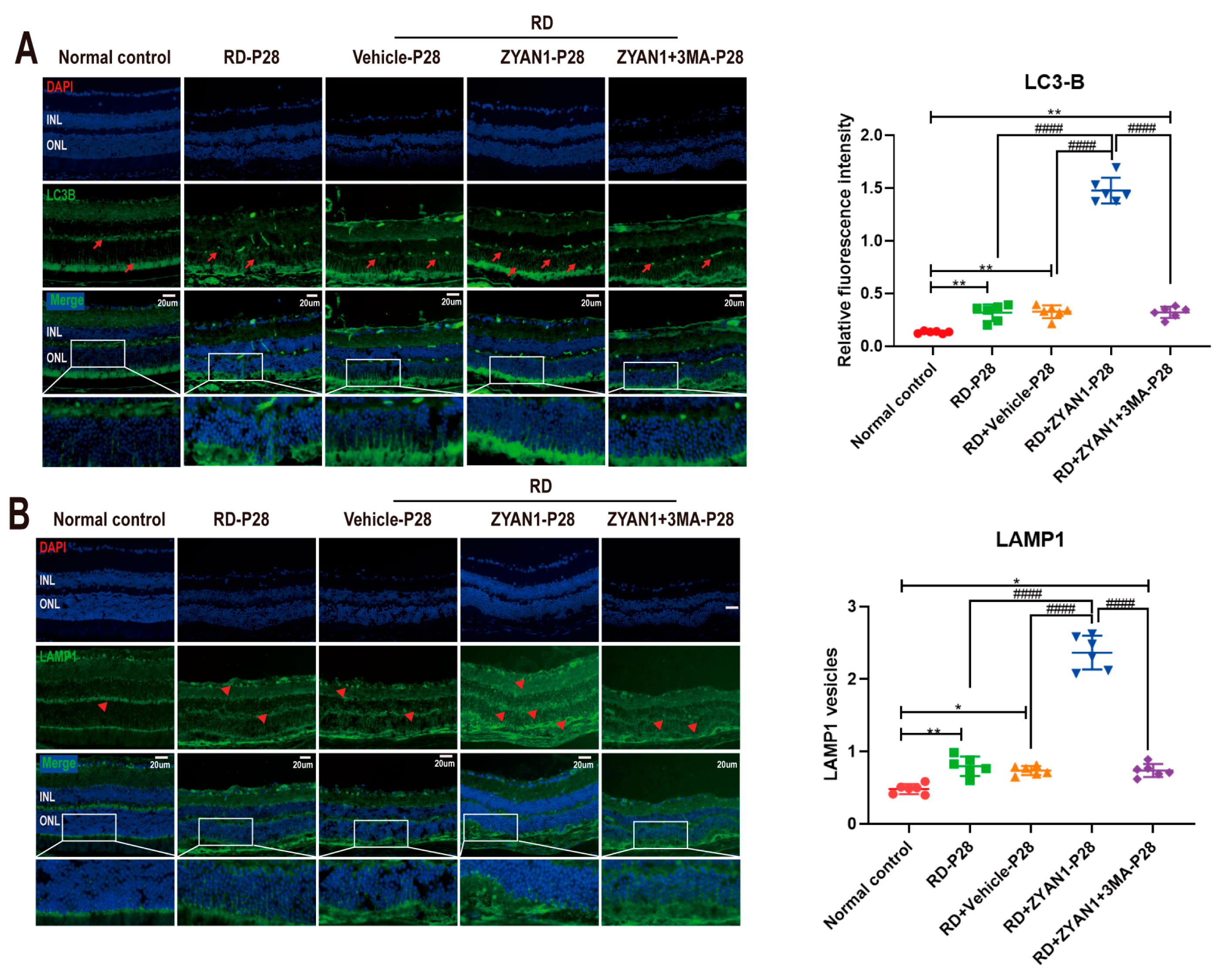 Antioxidants 12 01914 g011