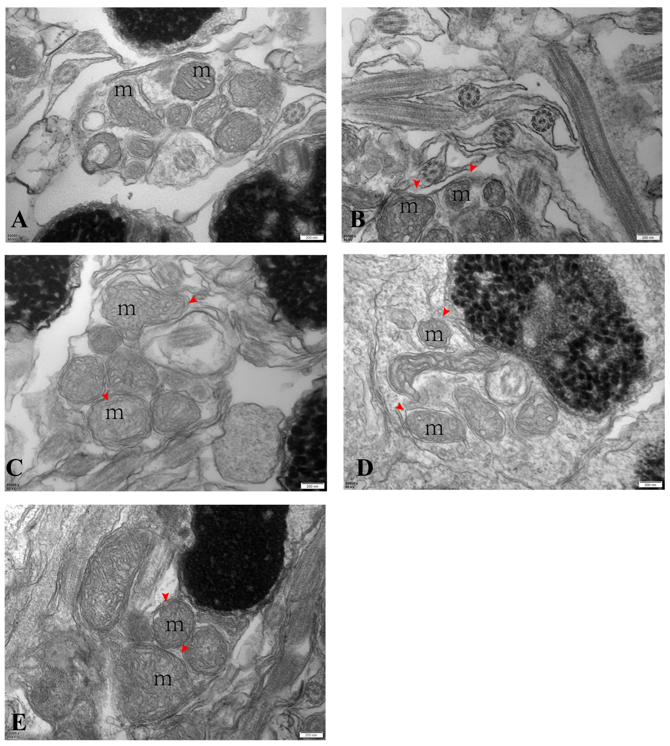 Delayed Reproduction, Injury, and Regeneration of Testes in