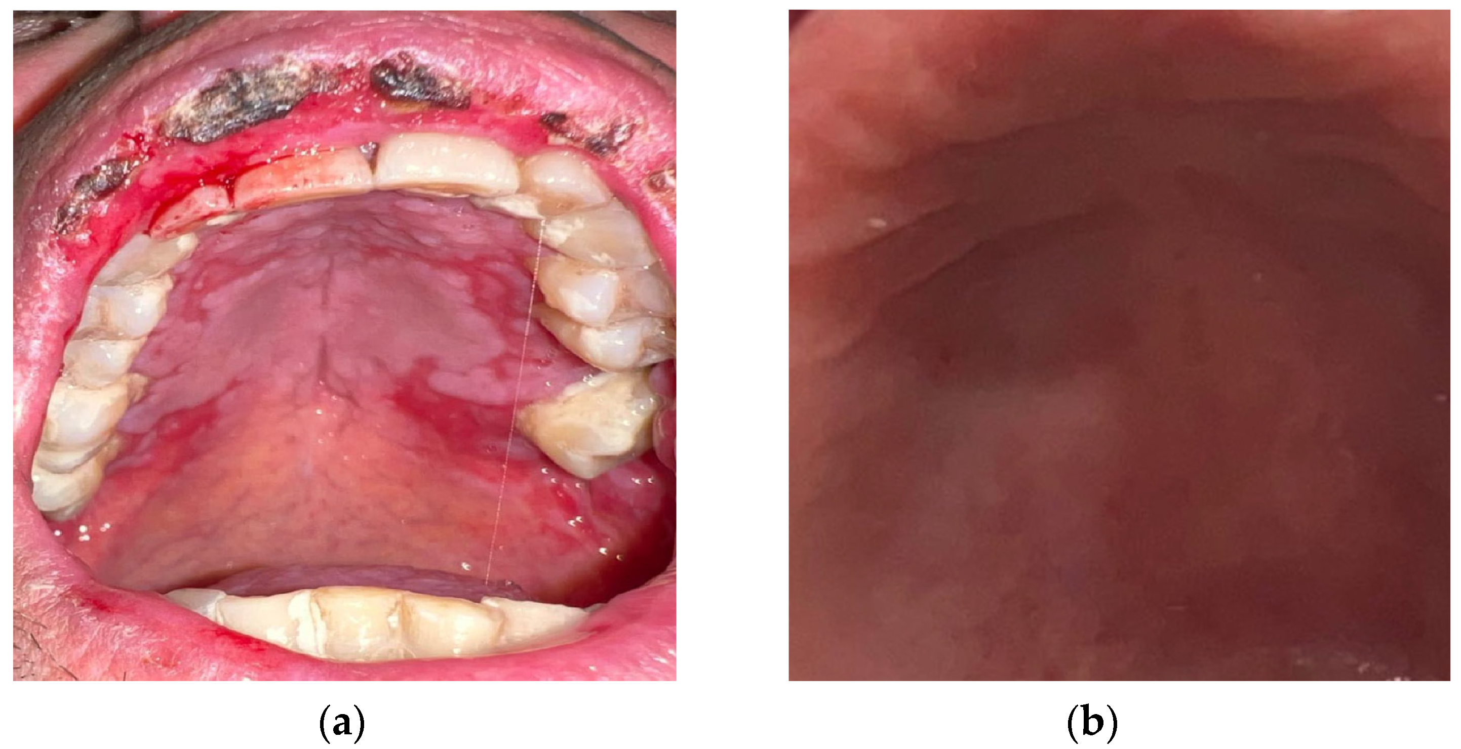 Antioxidants 13 01160 g004